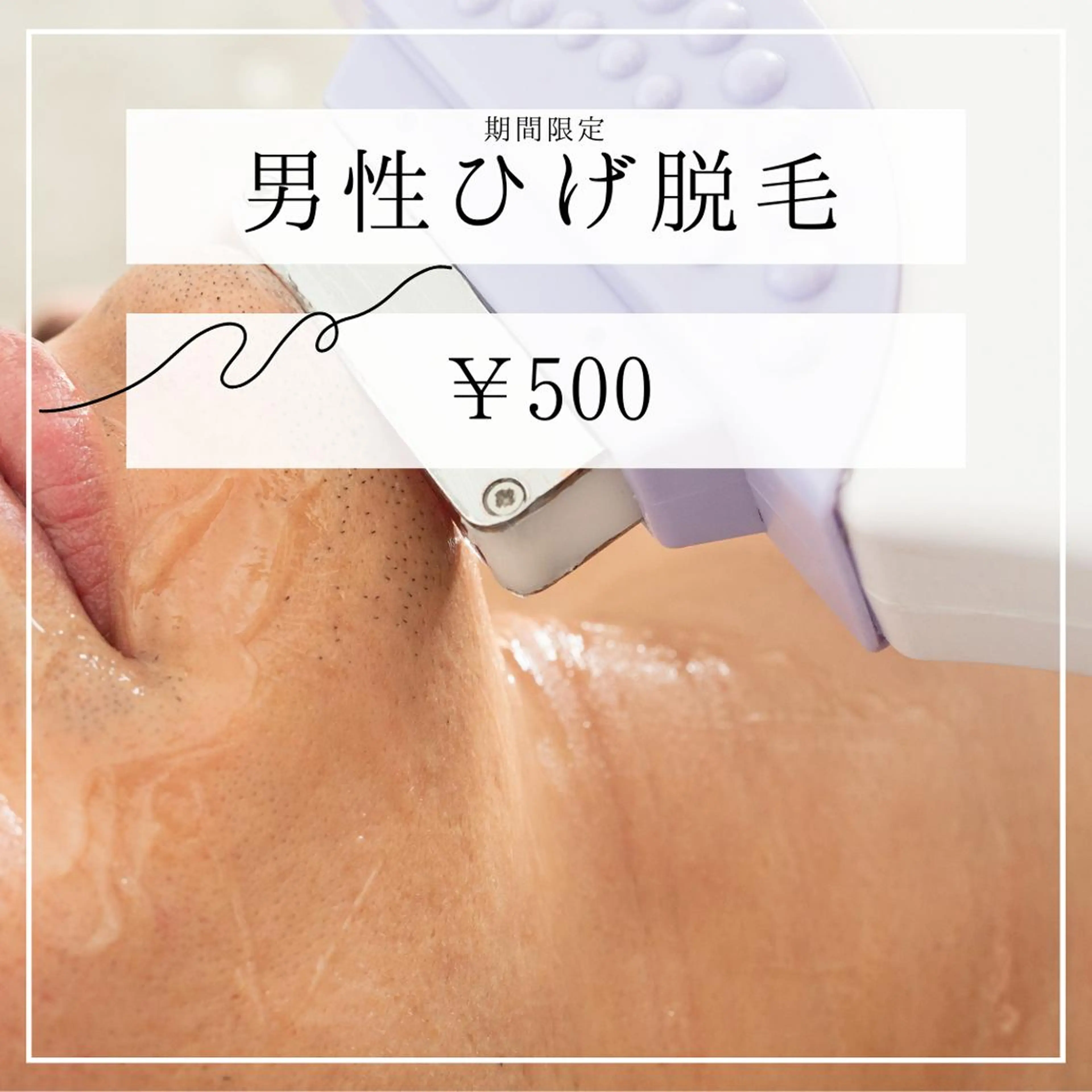 メンズ キッズ 20代から始める脱毛 salonLEPIAのエステ・リラクイメージ