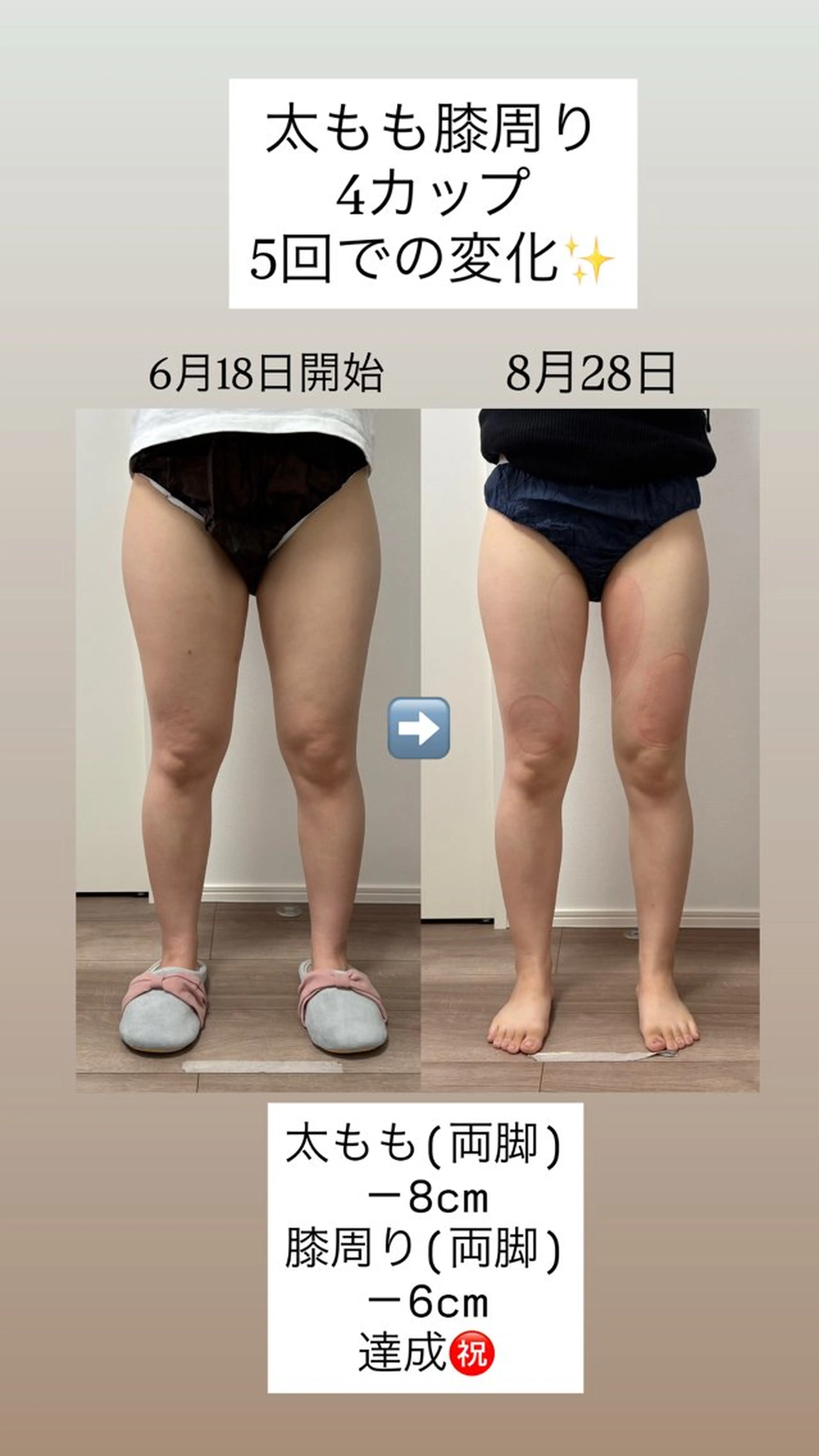Miiju.所属・Miiju. 石巻市 脂肪冷却  鈴木のエステ・リラクイメージ
