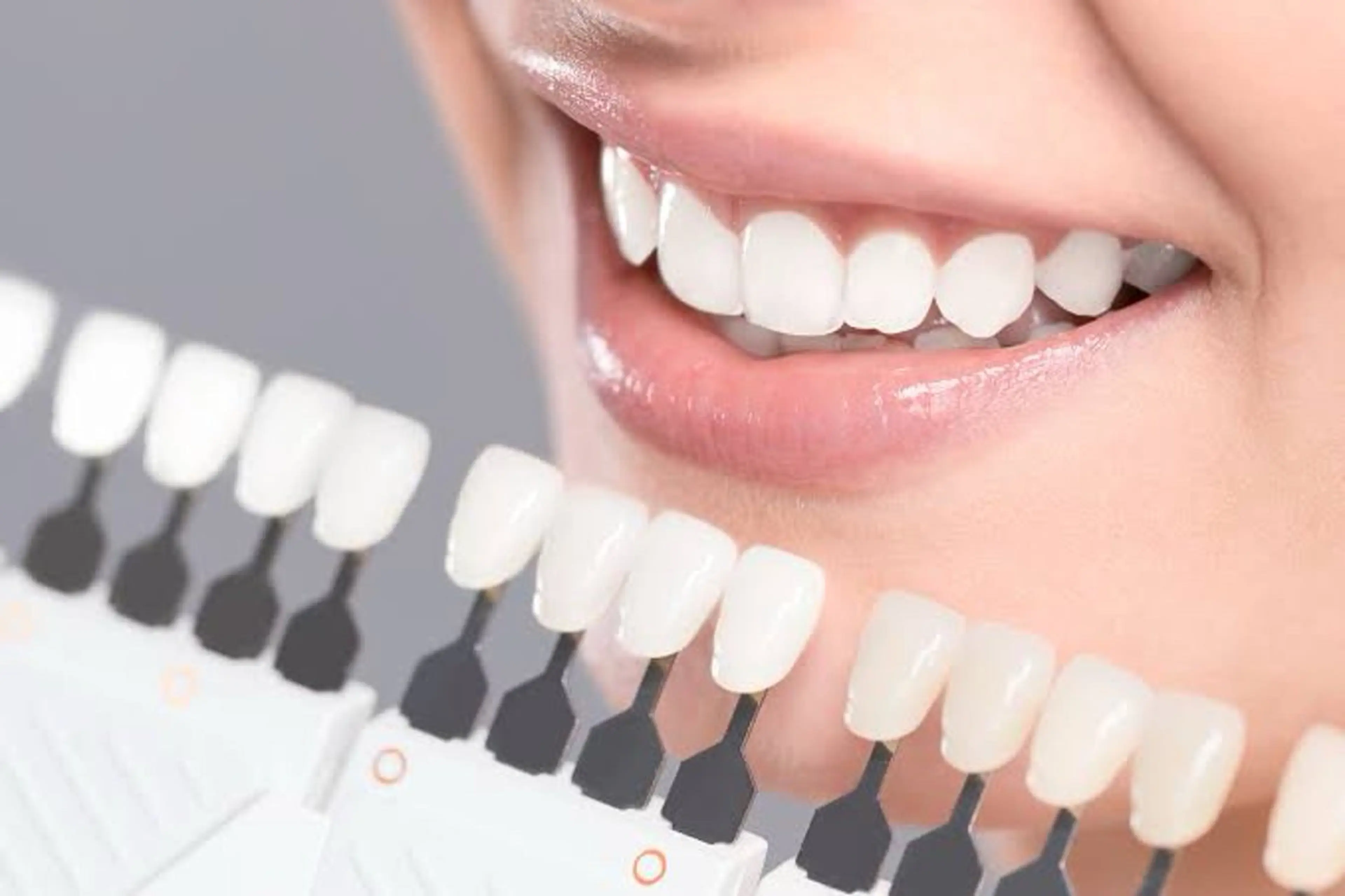 🦷医療監修❕ホワイトニング🦷の写真