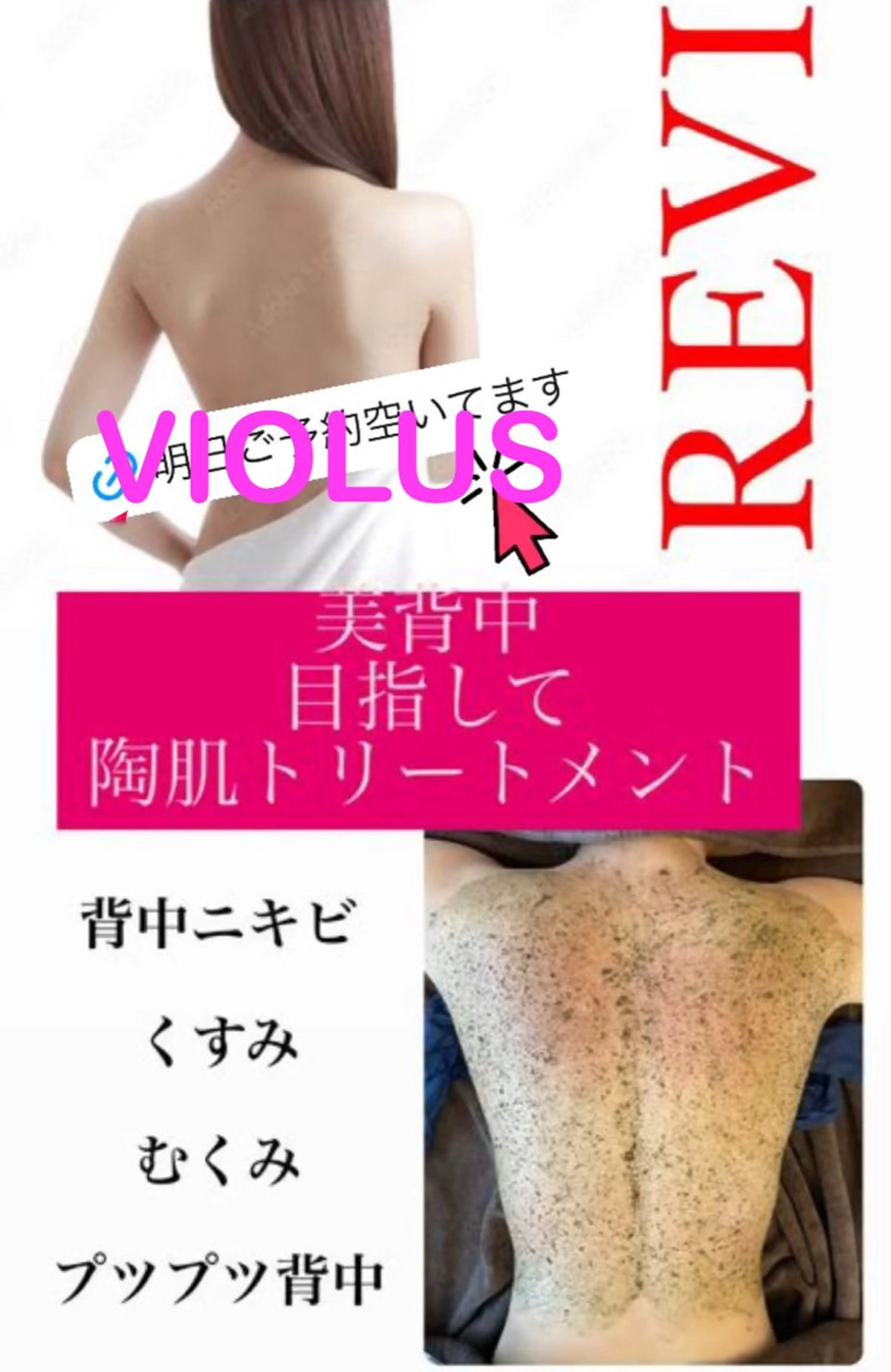背中美人コースの写真