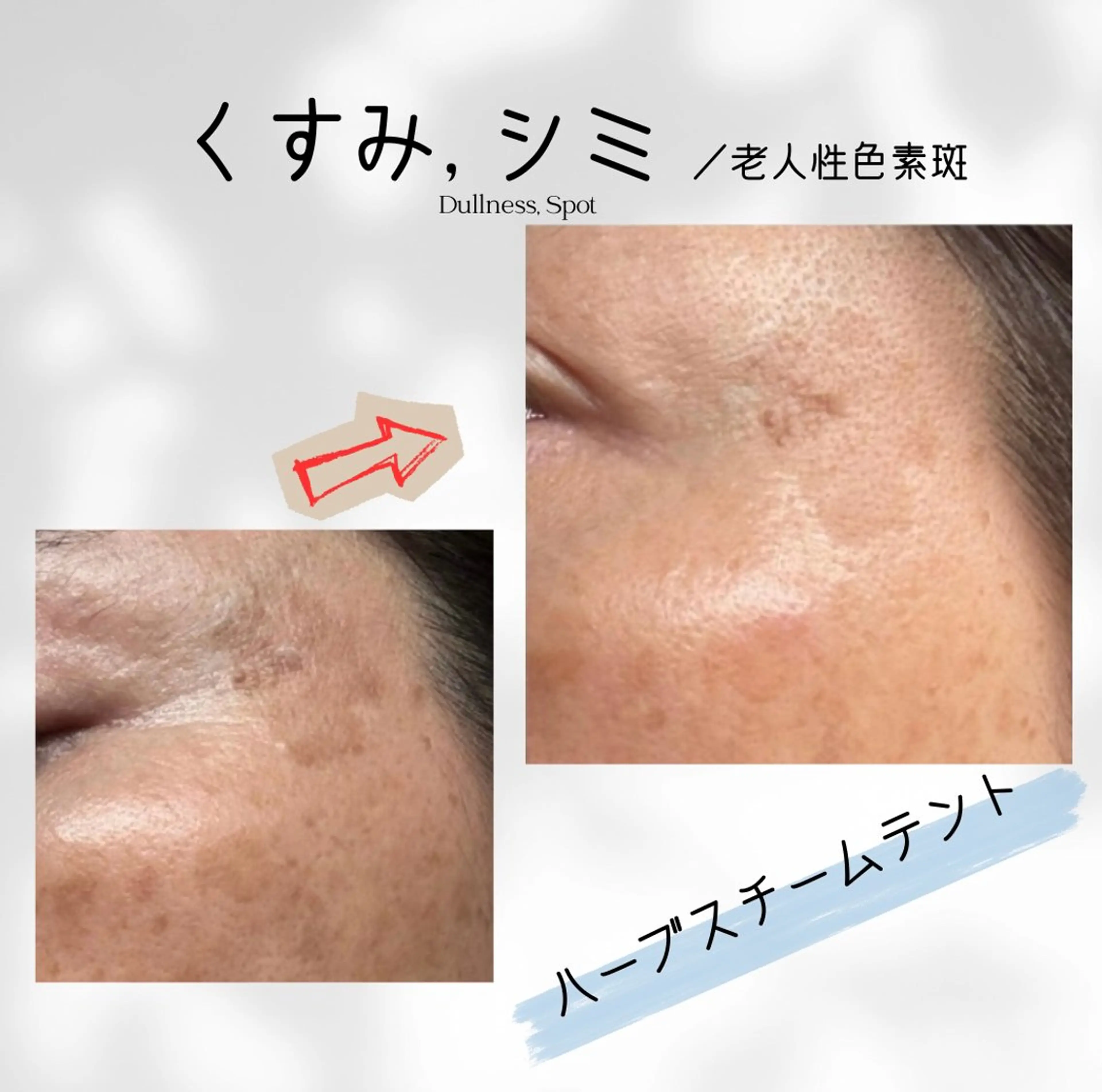 エステ リラク ハーブ蒸しサロン🌿 香嬉琉🌿きよかのエステ・リラクイメージ