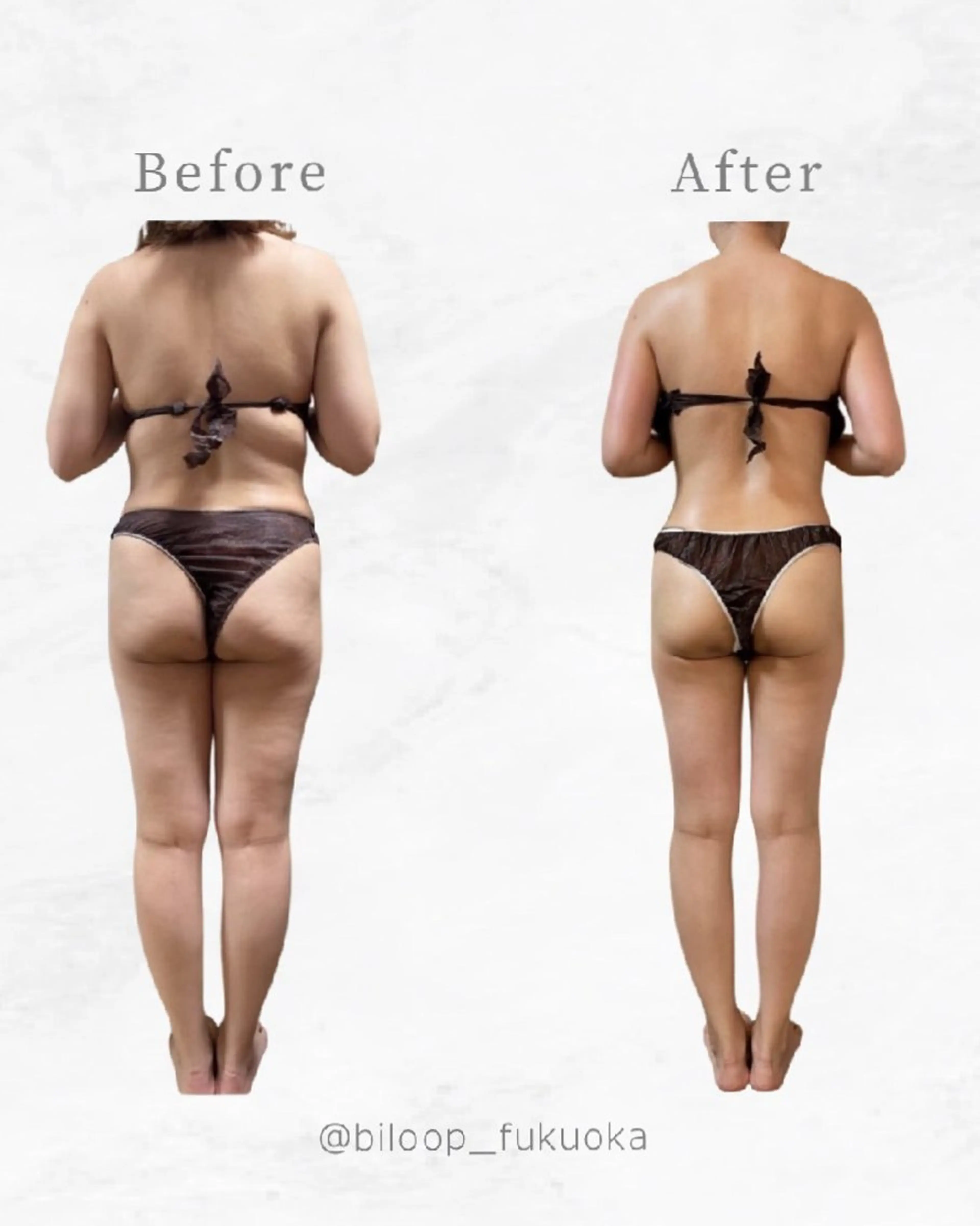 エステ リラク biloop所属・《痩身×疲労改善》 BILOOPのエステ・リラクイメージ