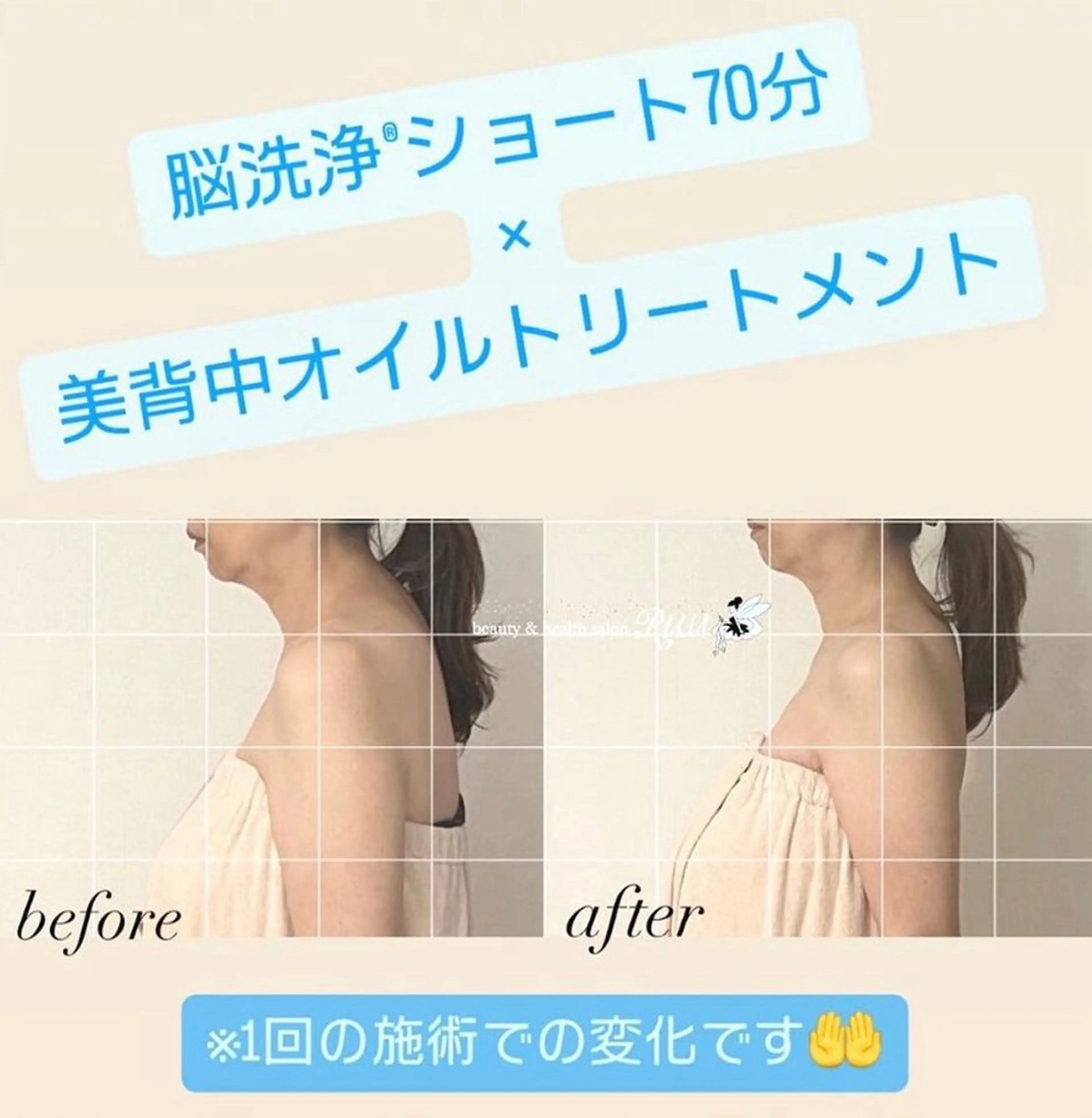 【頭痛、睡眠改善】 salon RUUのエステ・リラクイメージ