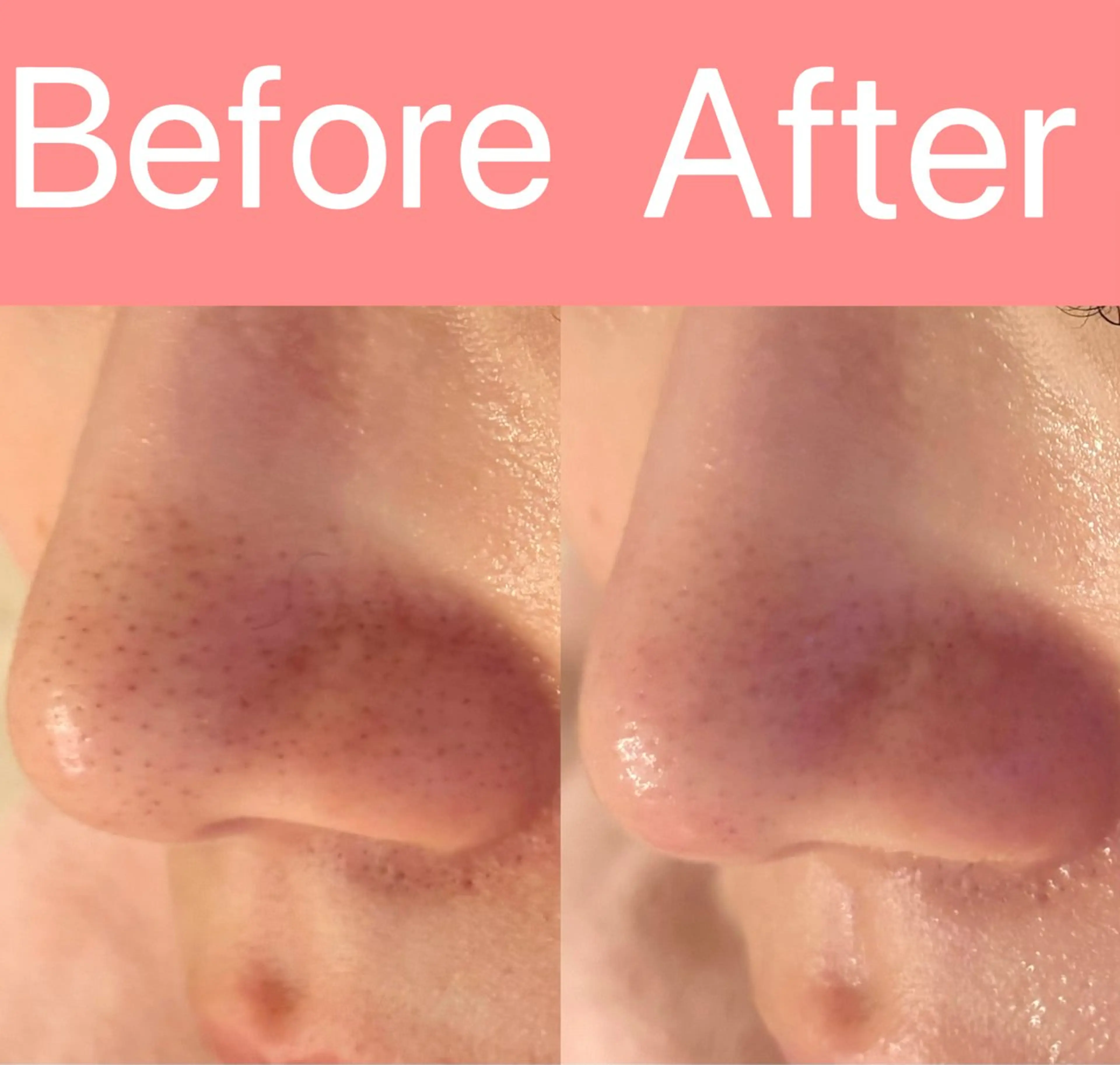 エステ アイラッシュ&エステサロンLinda西宮所属・小顔&毛穴・肌質改善 LINDA西宮 AIのエステ・リラクイメージ