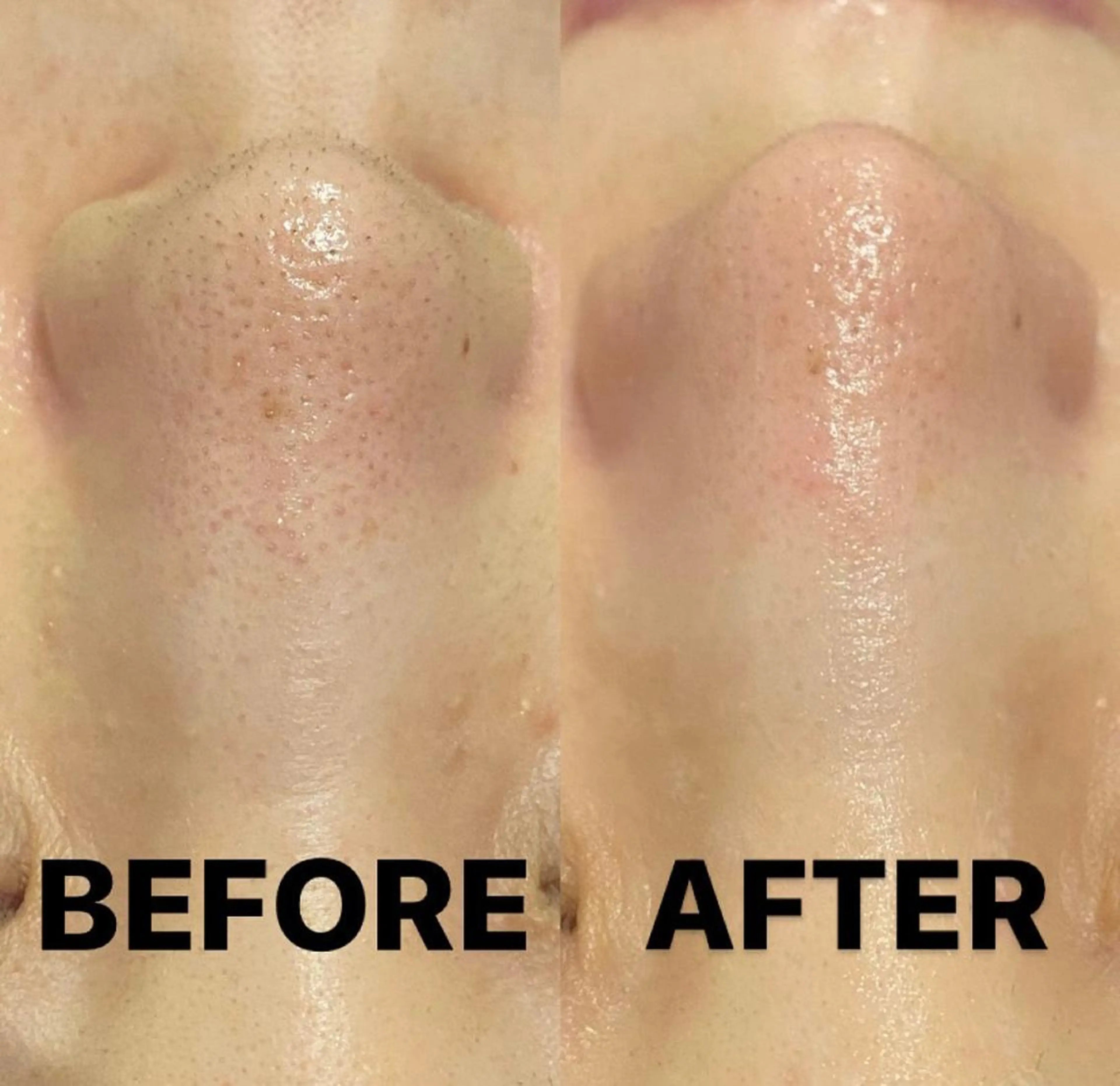 ミディアム カラー パーマ ヘアアレンジ メンズ キッズ ネイル マツエク・マツパ エステ リラク NANI OAFU所属・NANIOAFU [なんば店］のその他イメージ