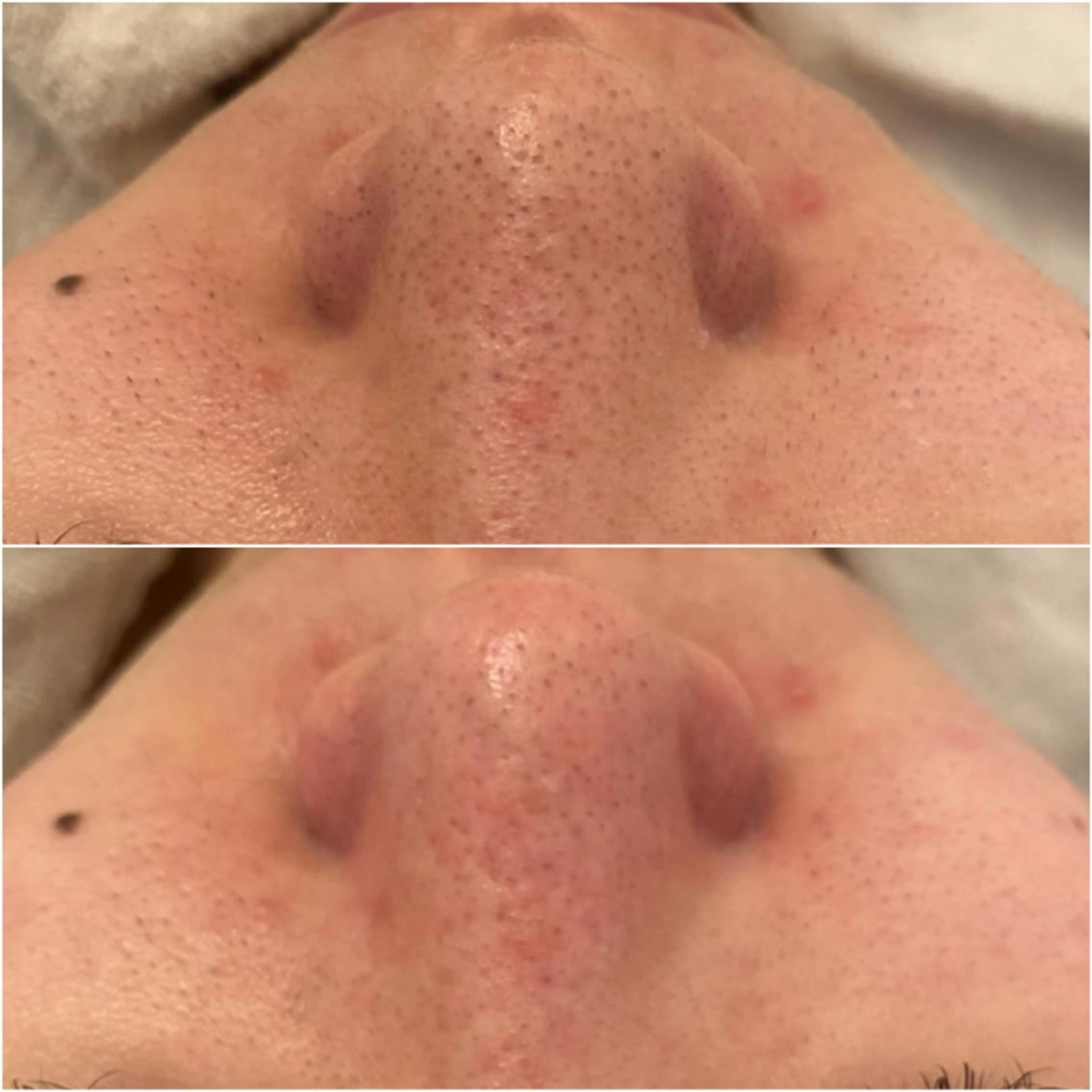 エステ ✨美肌水光✨ アトリエリュバンのエステ・リラクイメージ