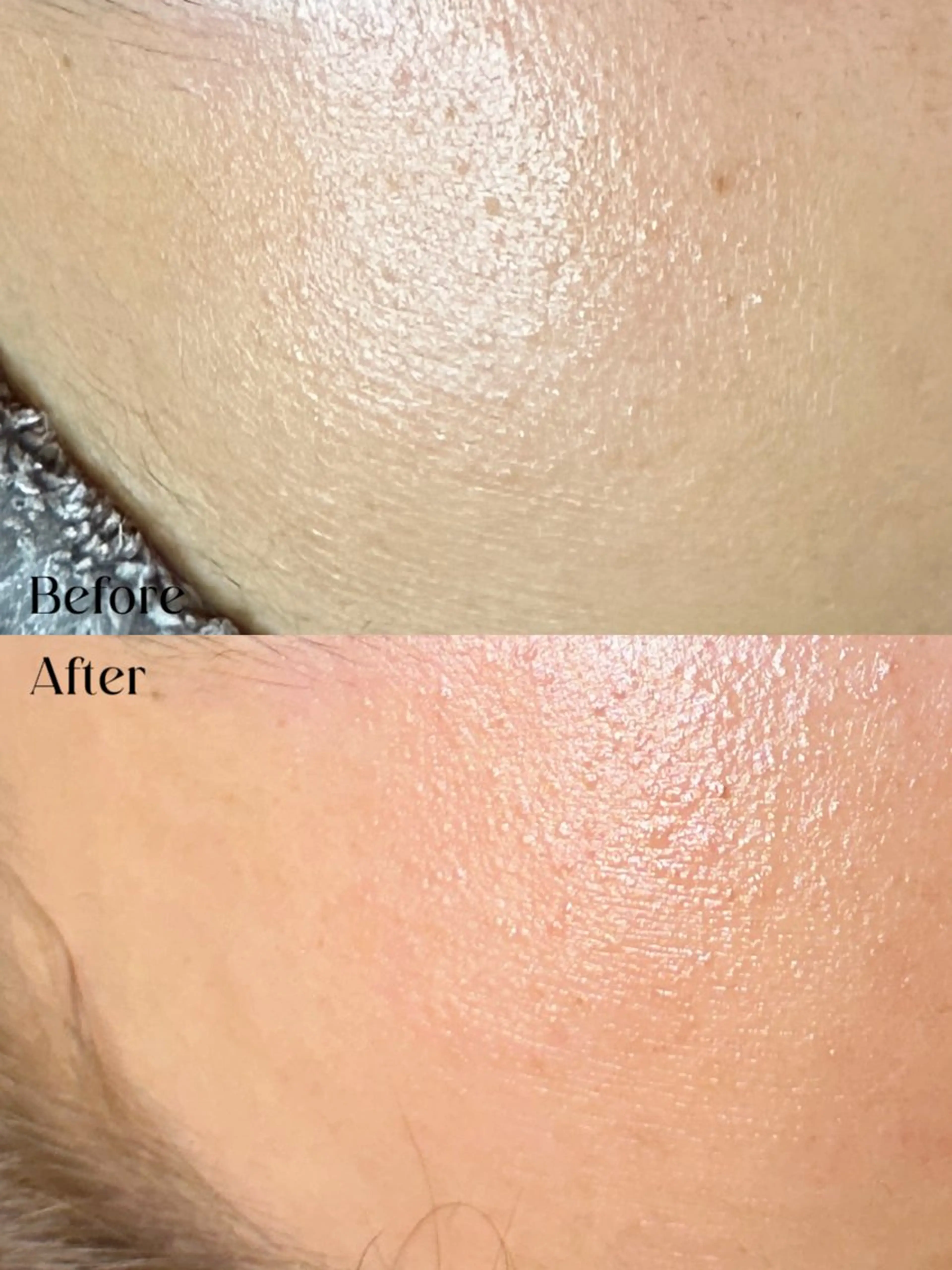 Hit. シュガーリング豊橋のエステ・リラクイメージ