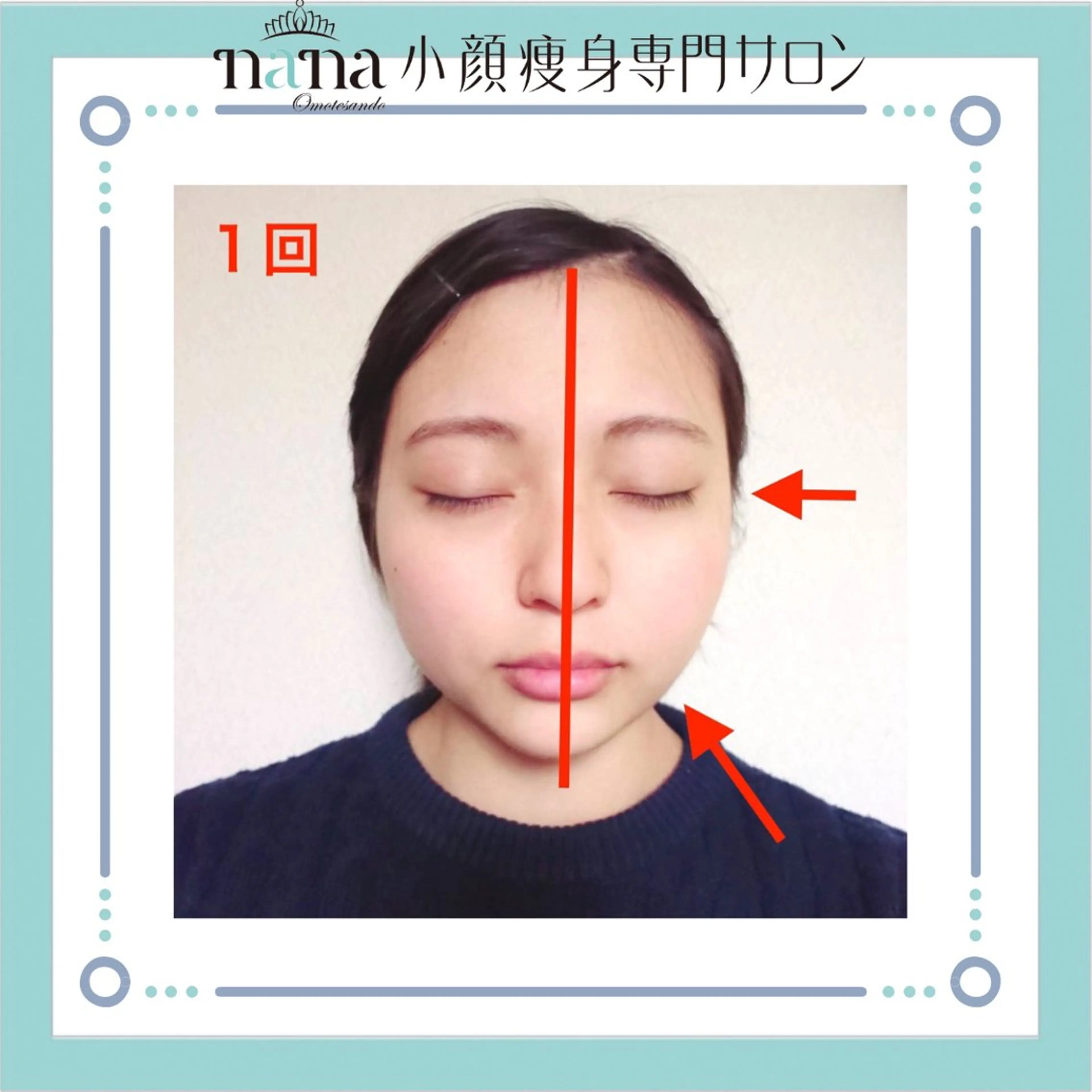 小顔痩身インディバ Nana表参道のエステ・リラクイメージ