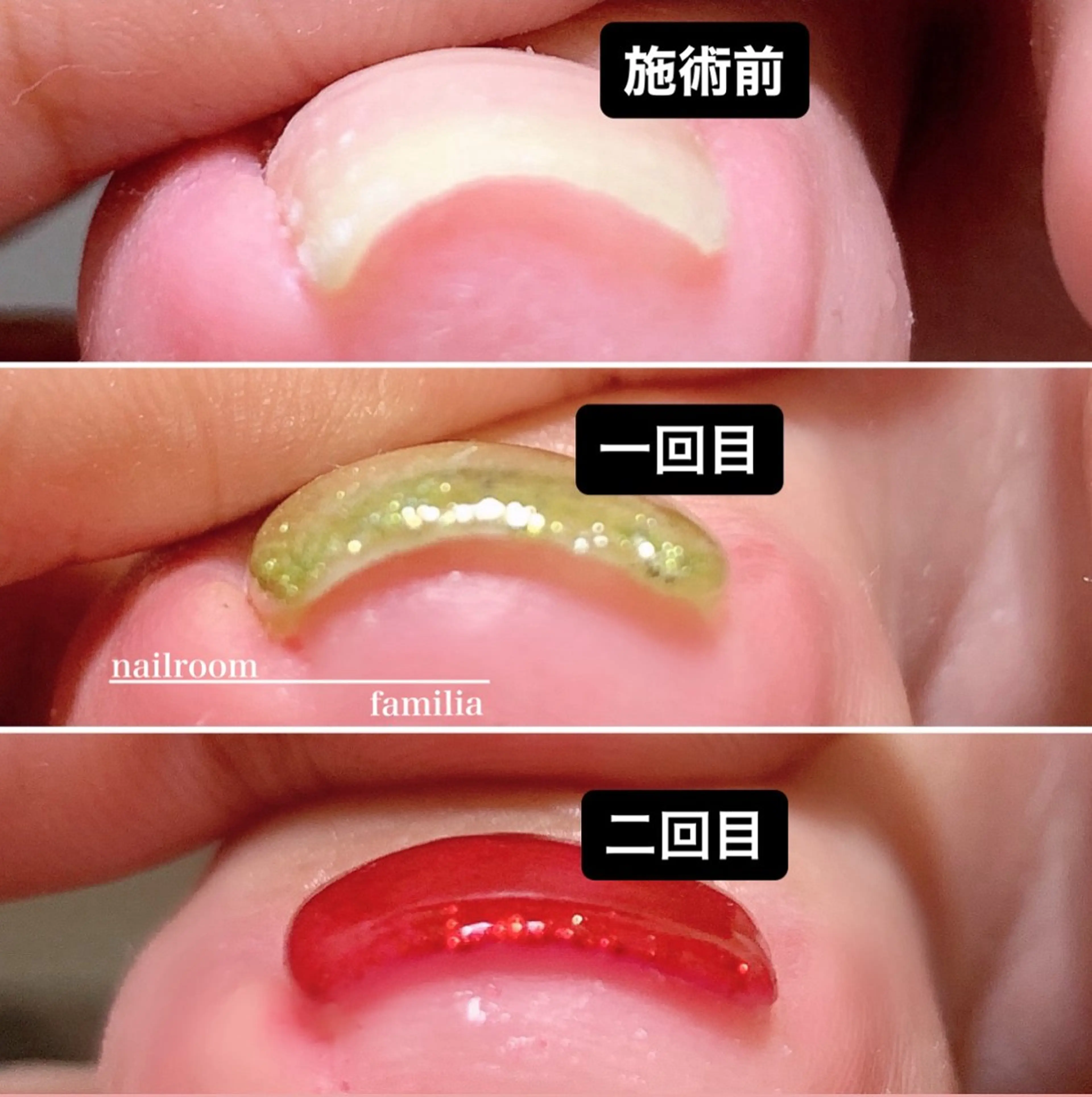 ネイル フットネイル -nailroom- familiaのネイルデザイン