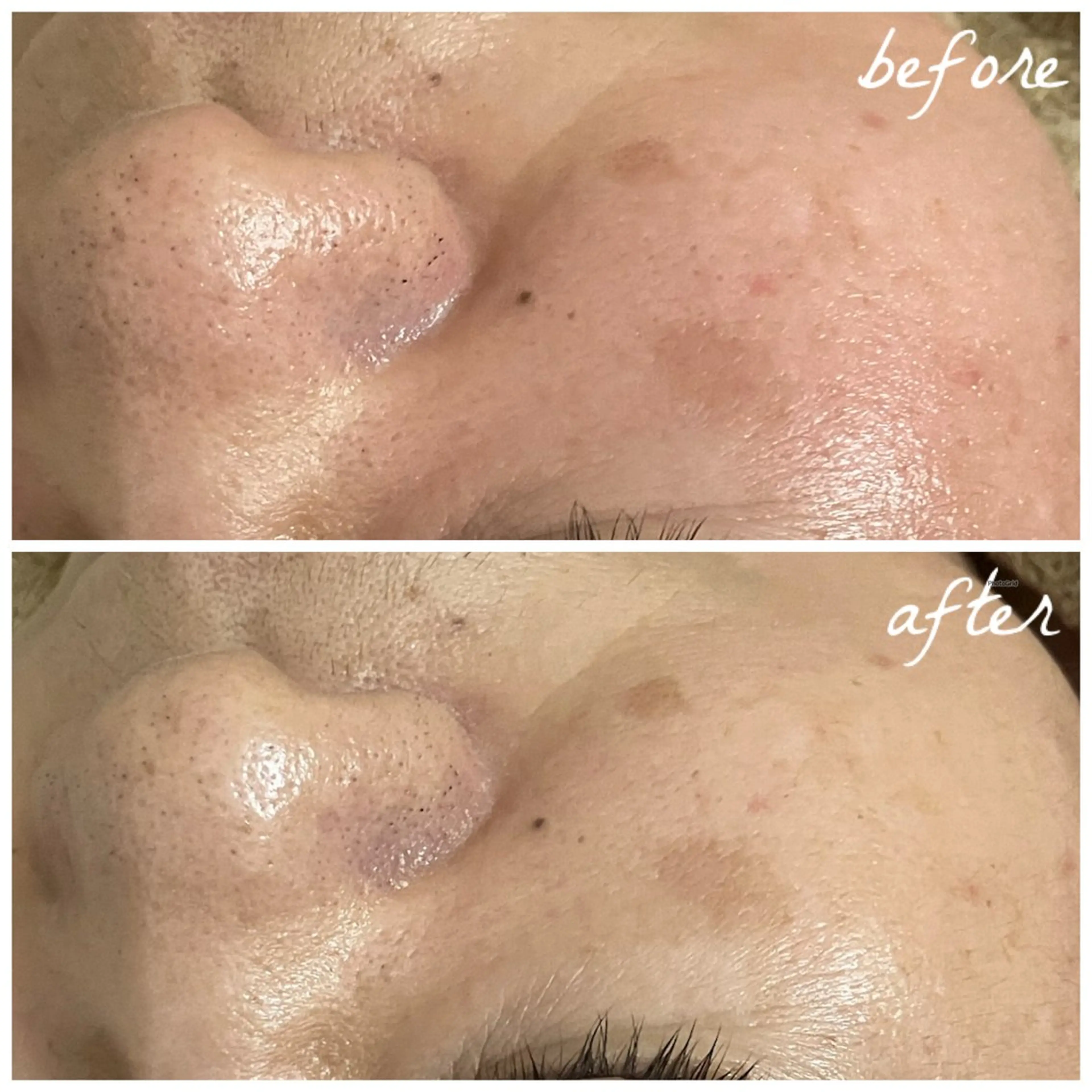 メンズ エステ メナード岐阜茜部 杉浦のエステ・リラクイメージ