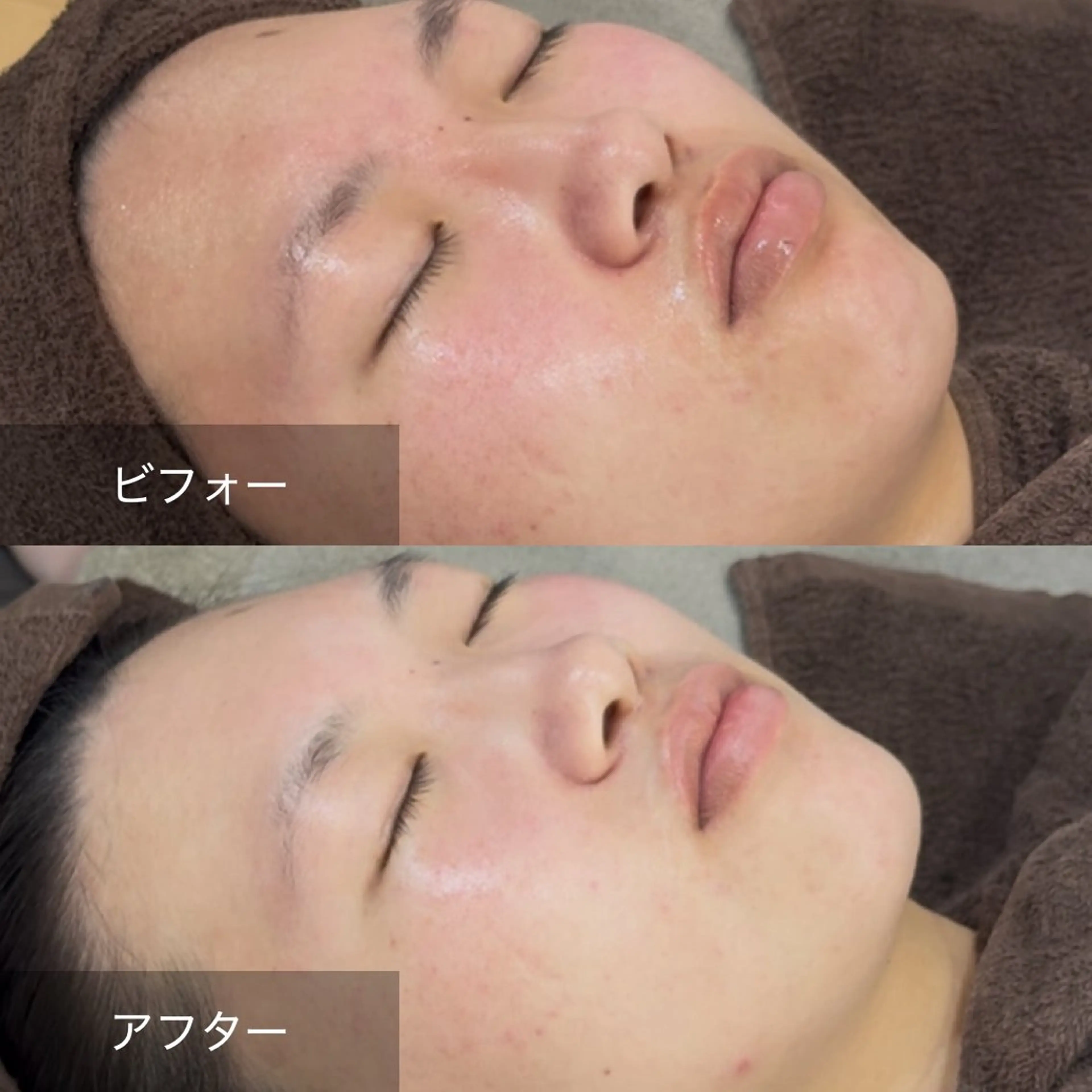 エステ 美sorciere所属・現役看護師サロン めぐみのエステ・リラクイメージ