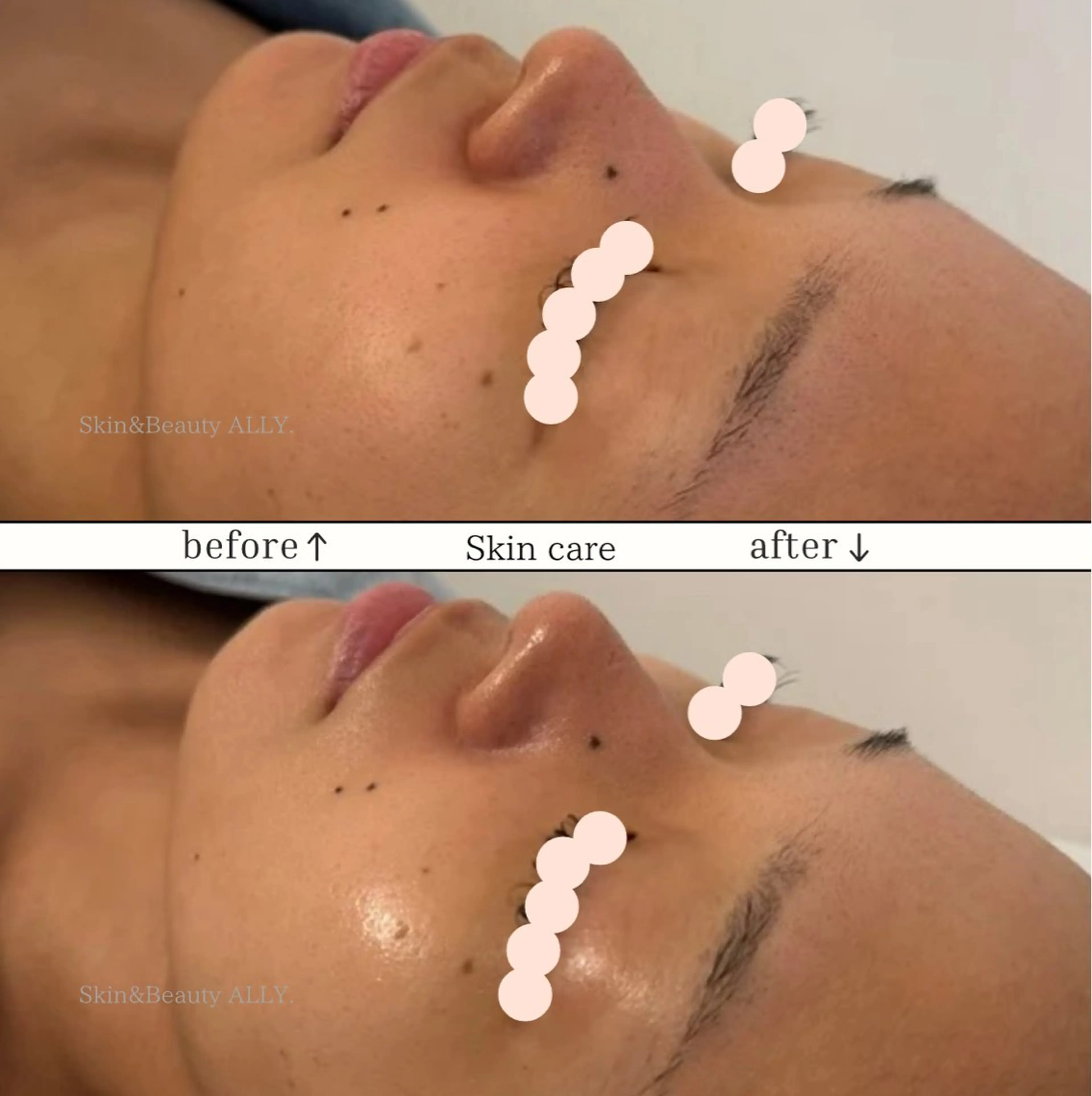 エステ 艶肌ワックス ALLY.のエステ・リラクイメージ