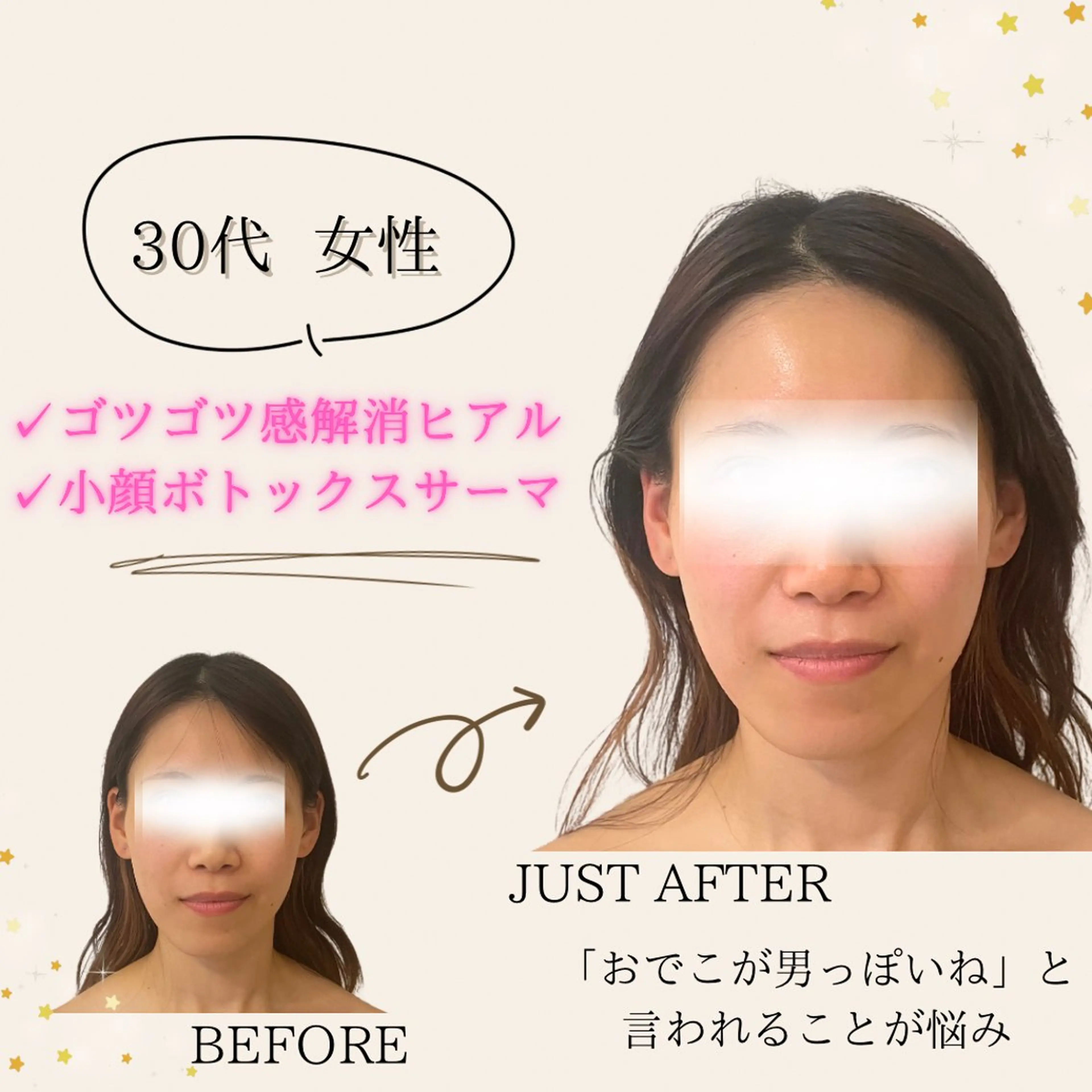 エステ 小顔/たるみ/黒ずみ除去専門サロン/SONA 大和西大寺店所属・【小顔専門看護師 サロンSONA】のエステ・リラクイメージ