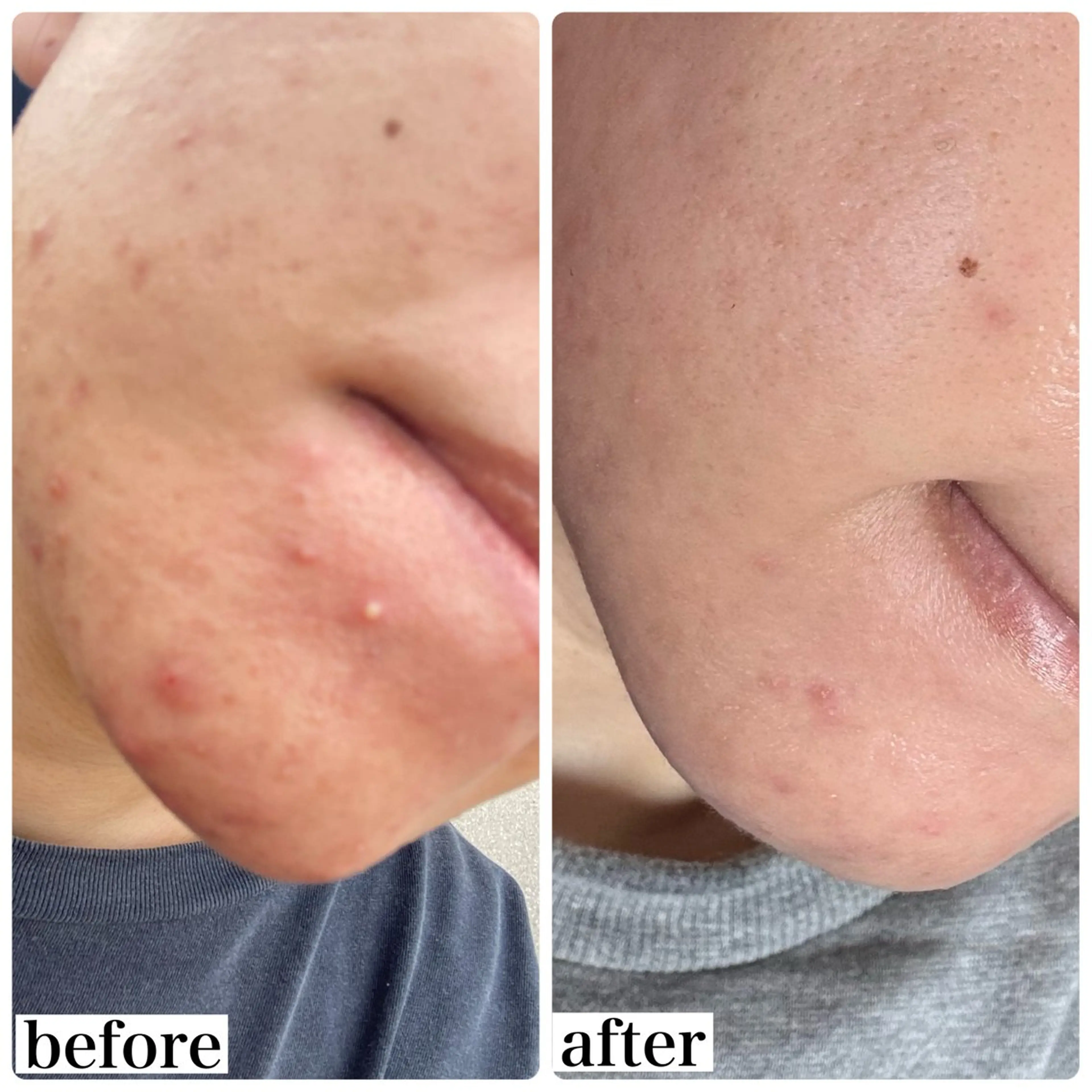 エステ WHITE AQUA 北千住店のエステ・リラクイメージ