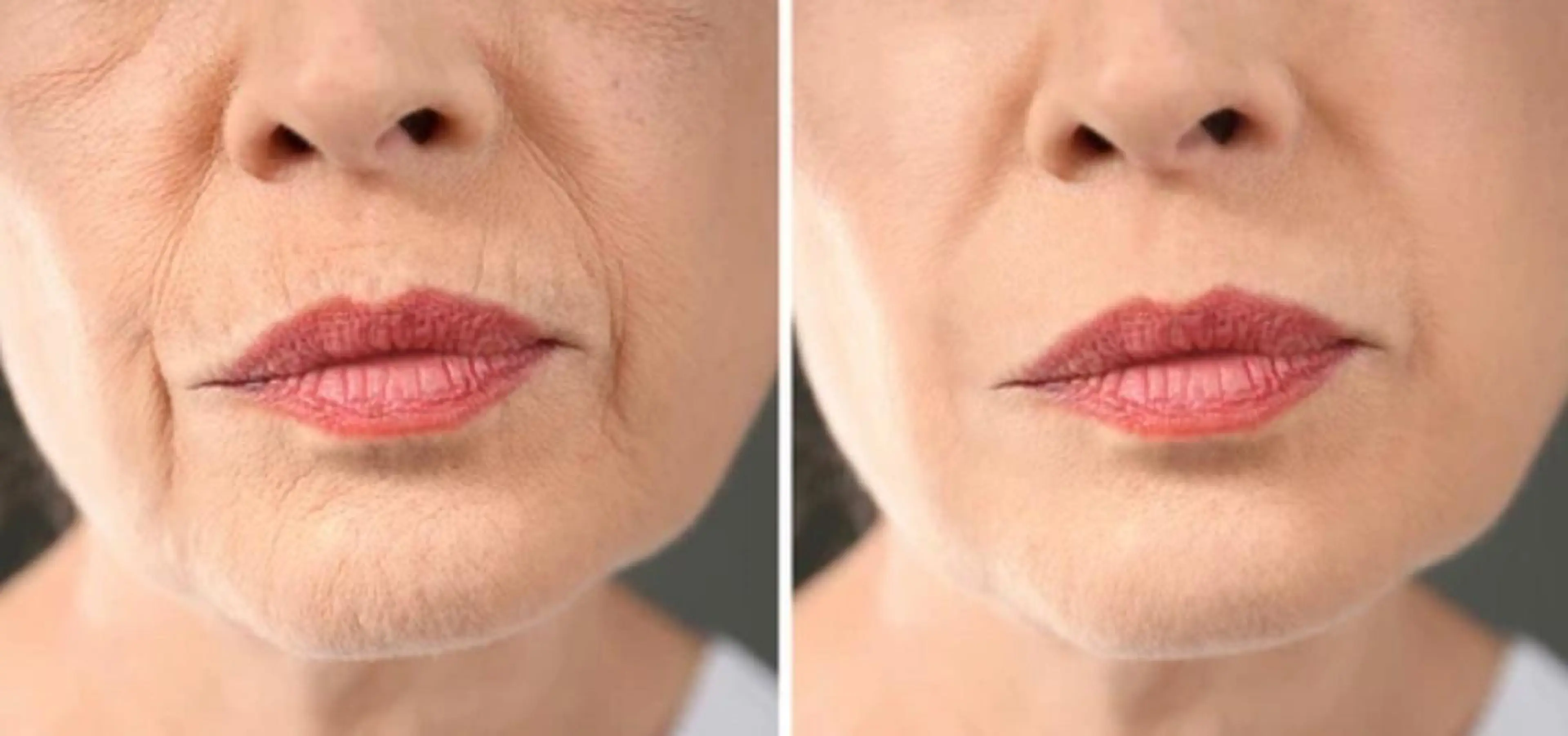 小顔痩身インディバ Nana表参道のエステ・リラクイメージ