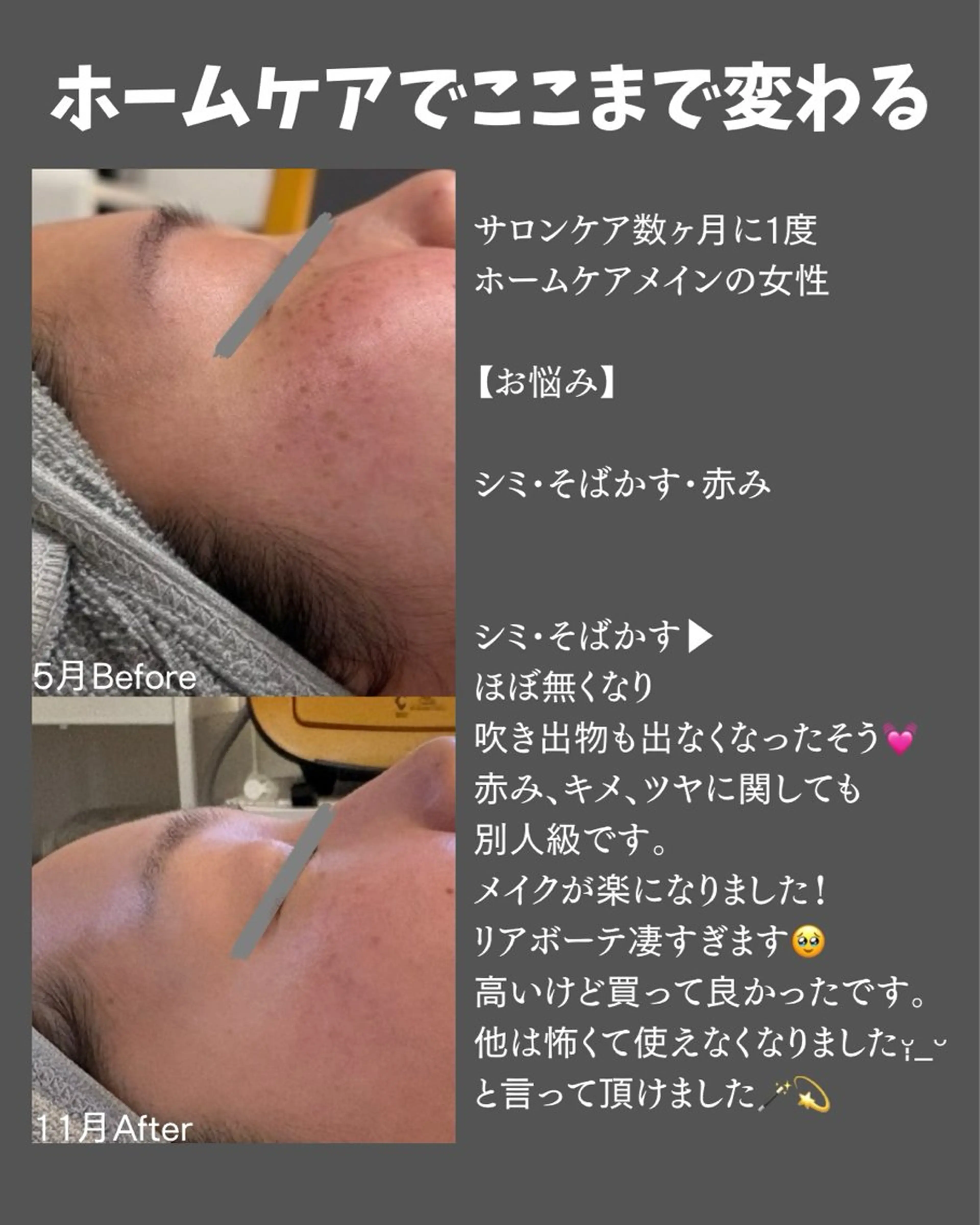 BLOSSOM 菊地のエステ・リラクイメージ