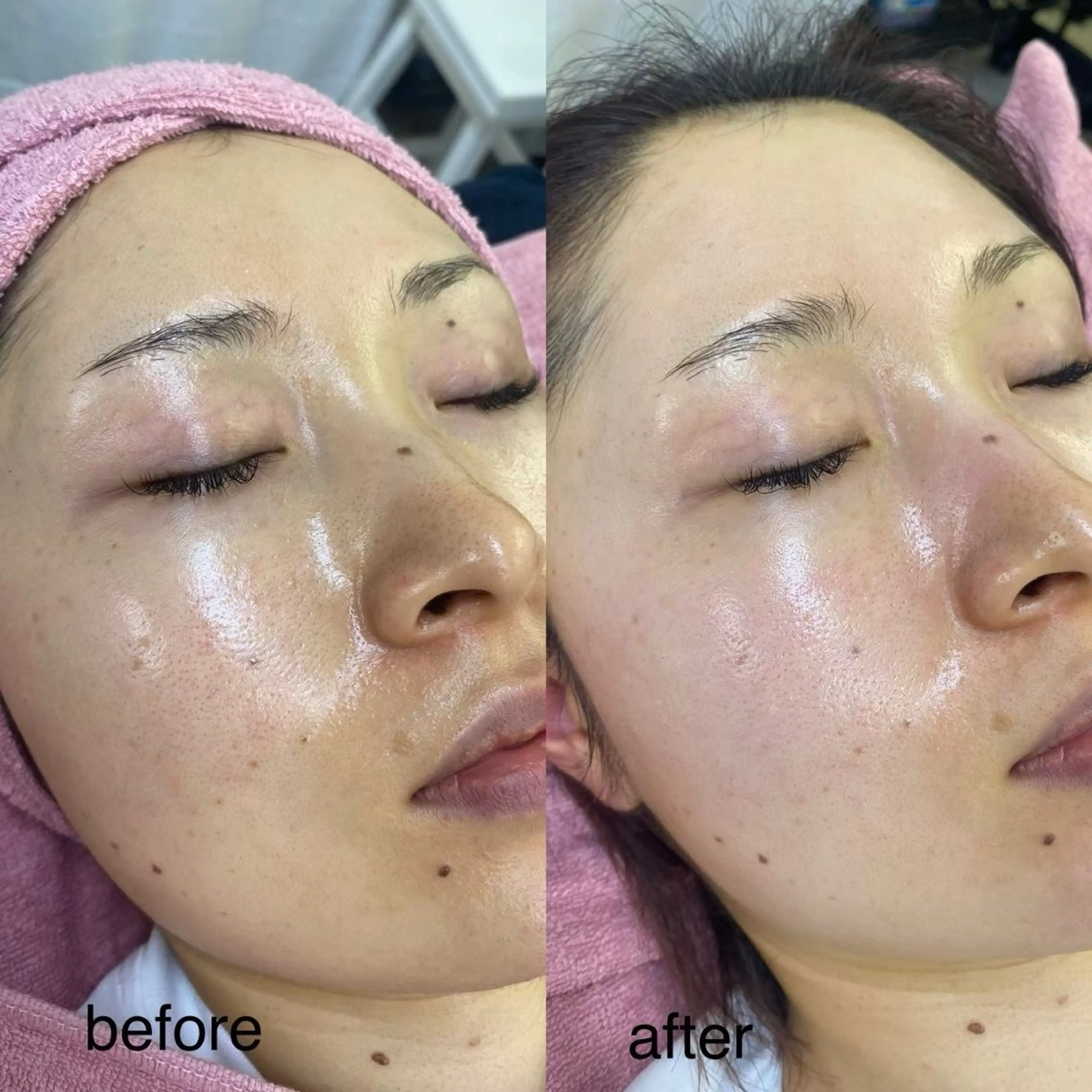 siro スタッフのエステ・リラクイメージ