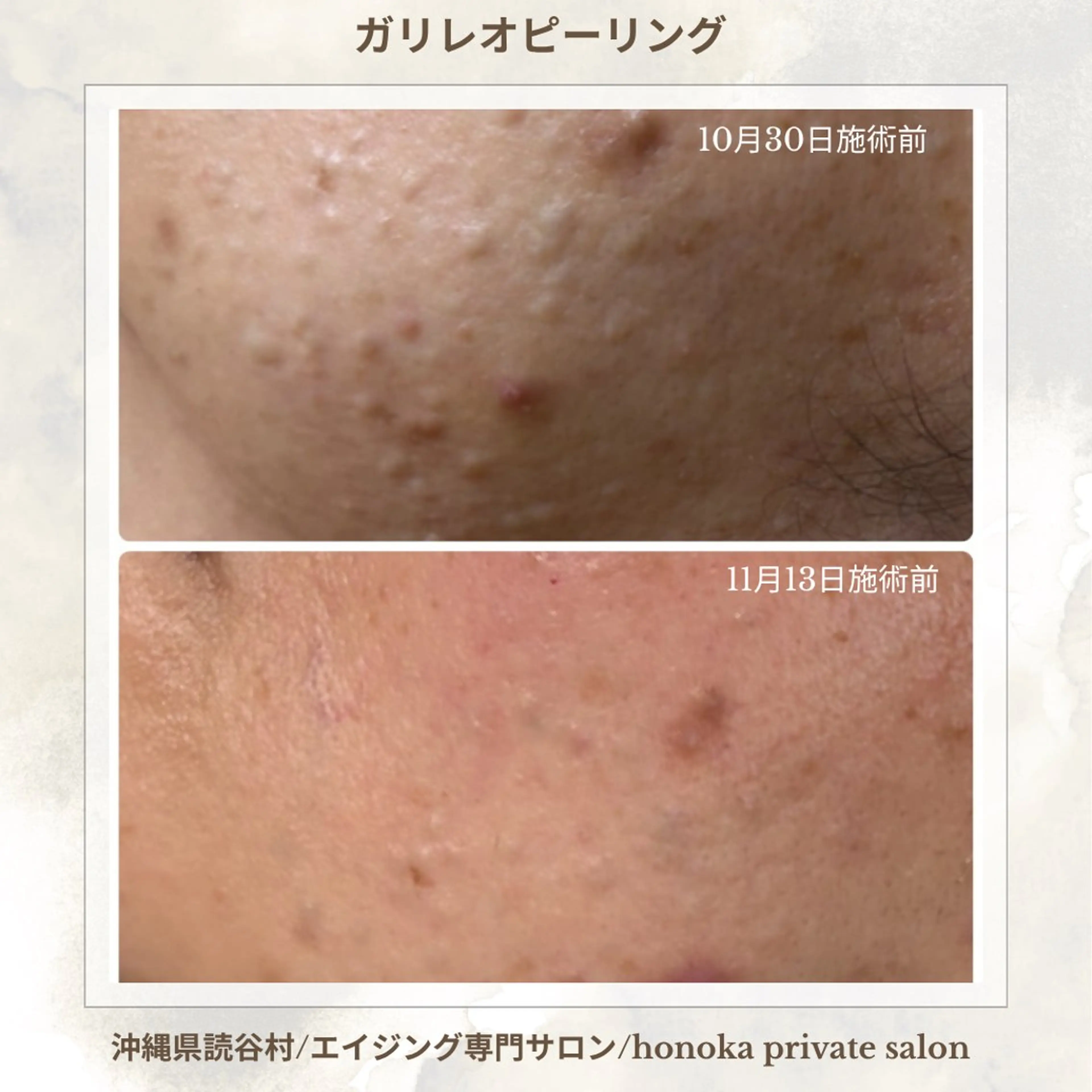 エステ 知念 美由紀のエステ・リラクイメージ