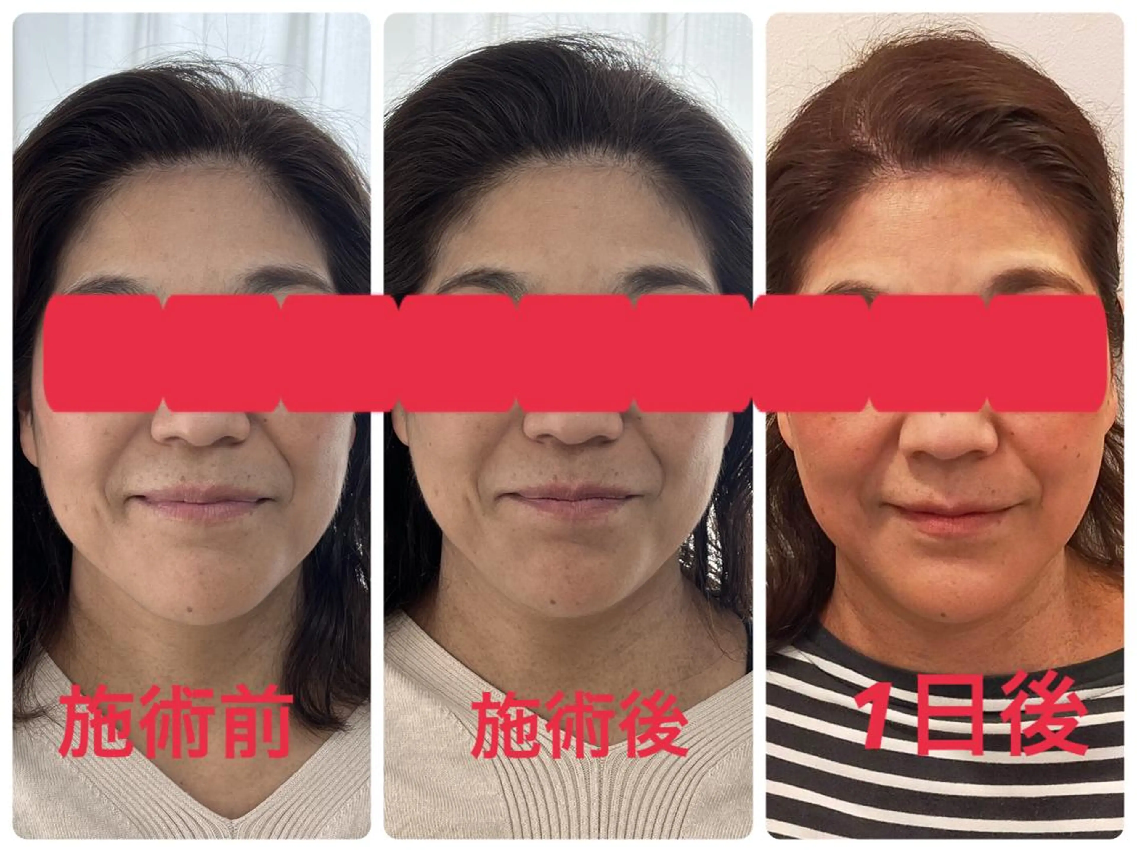 Serapia 【セラピア】のマツエク・マツパデザイン