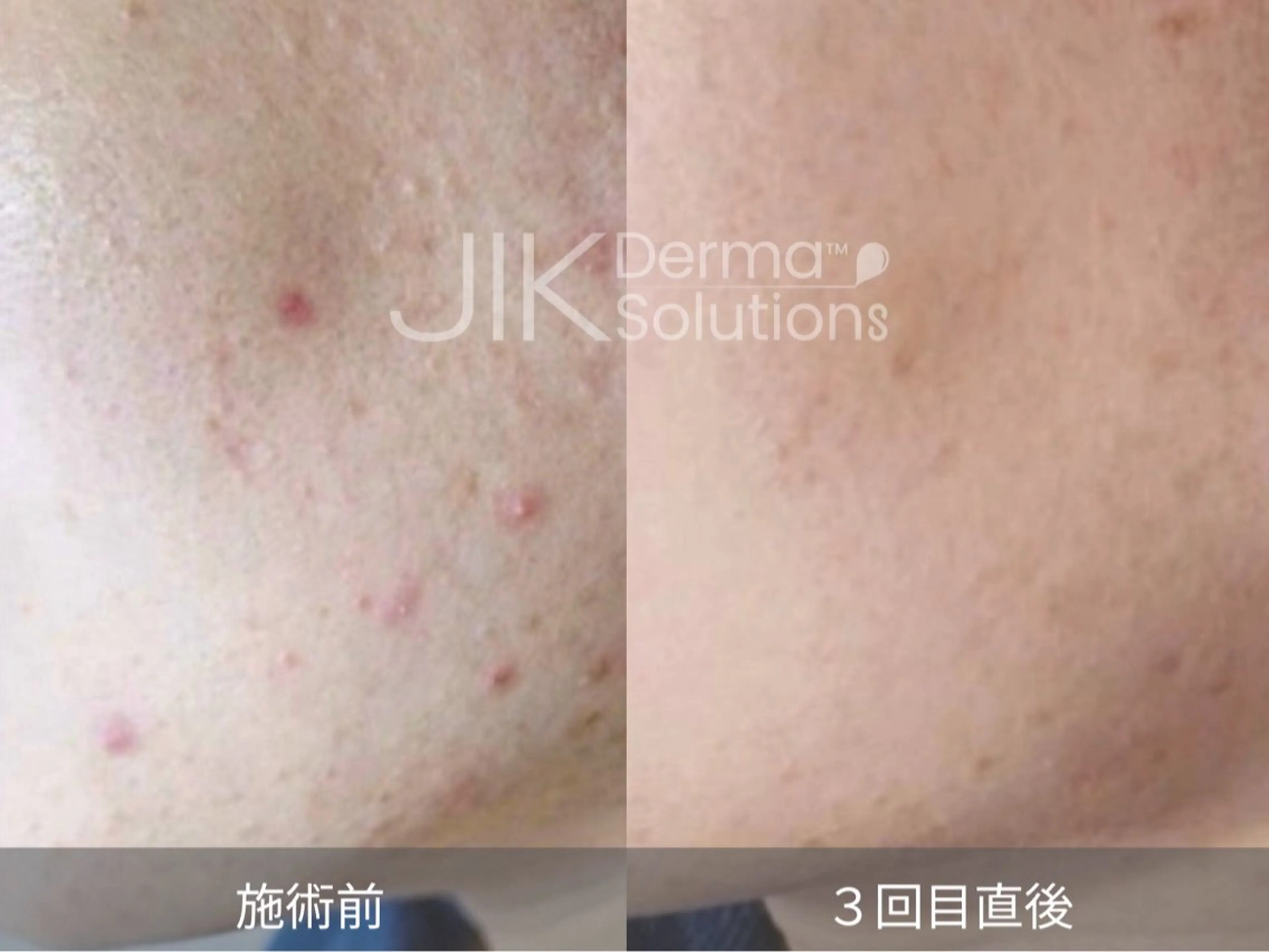 Lady Luck BAY RESORT所属・Lady Luck Akaneのエステ・リラクイメージ