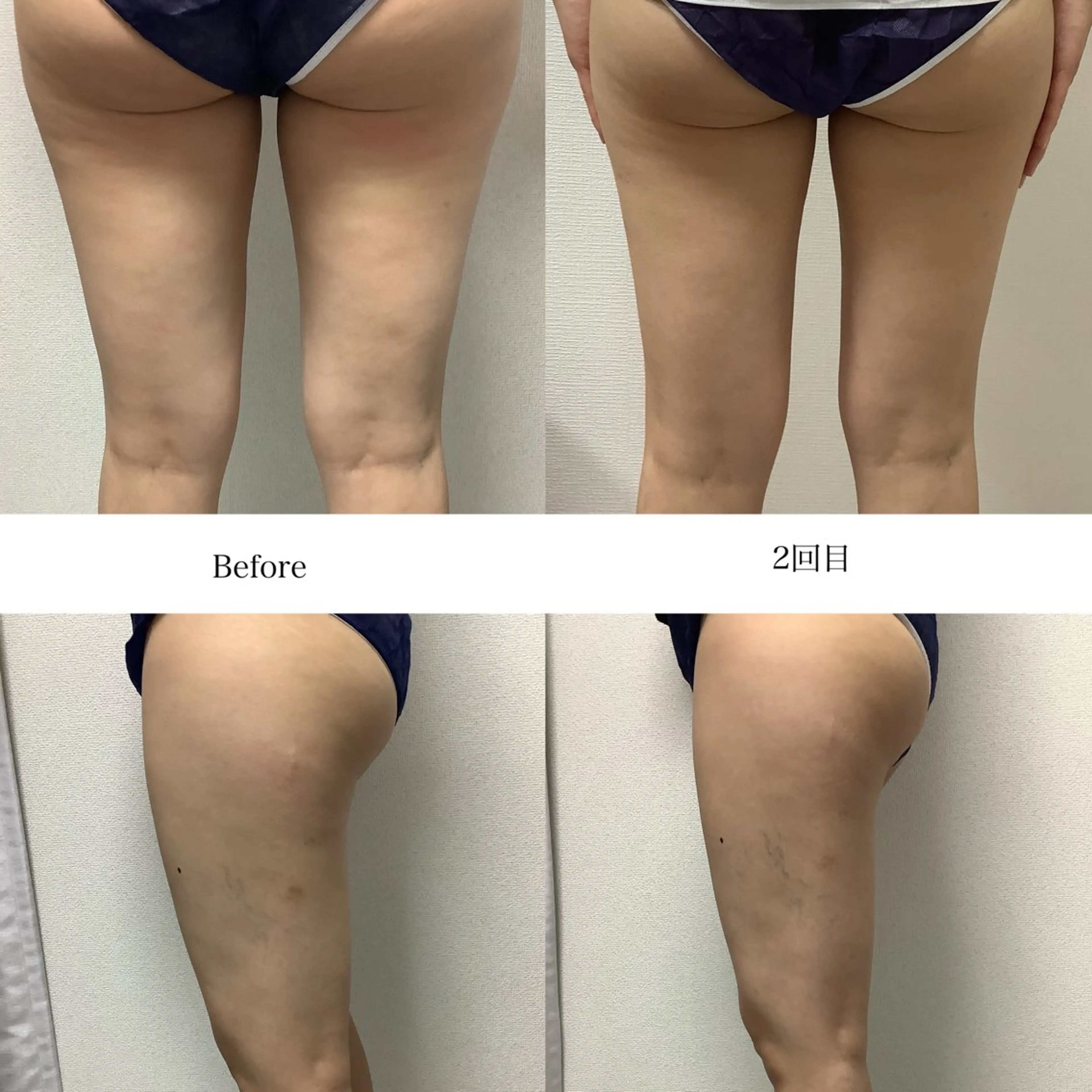 冷却専門店 SLARIのエステ・リラクイメージ