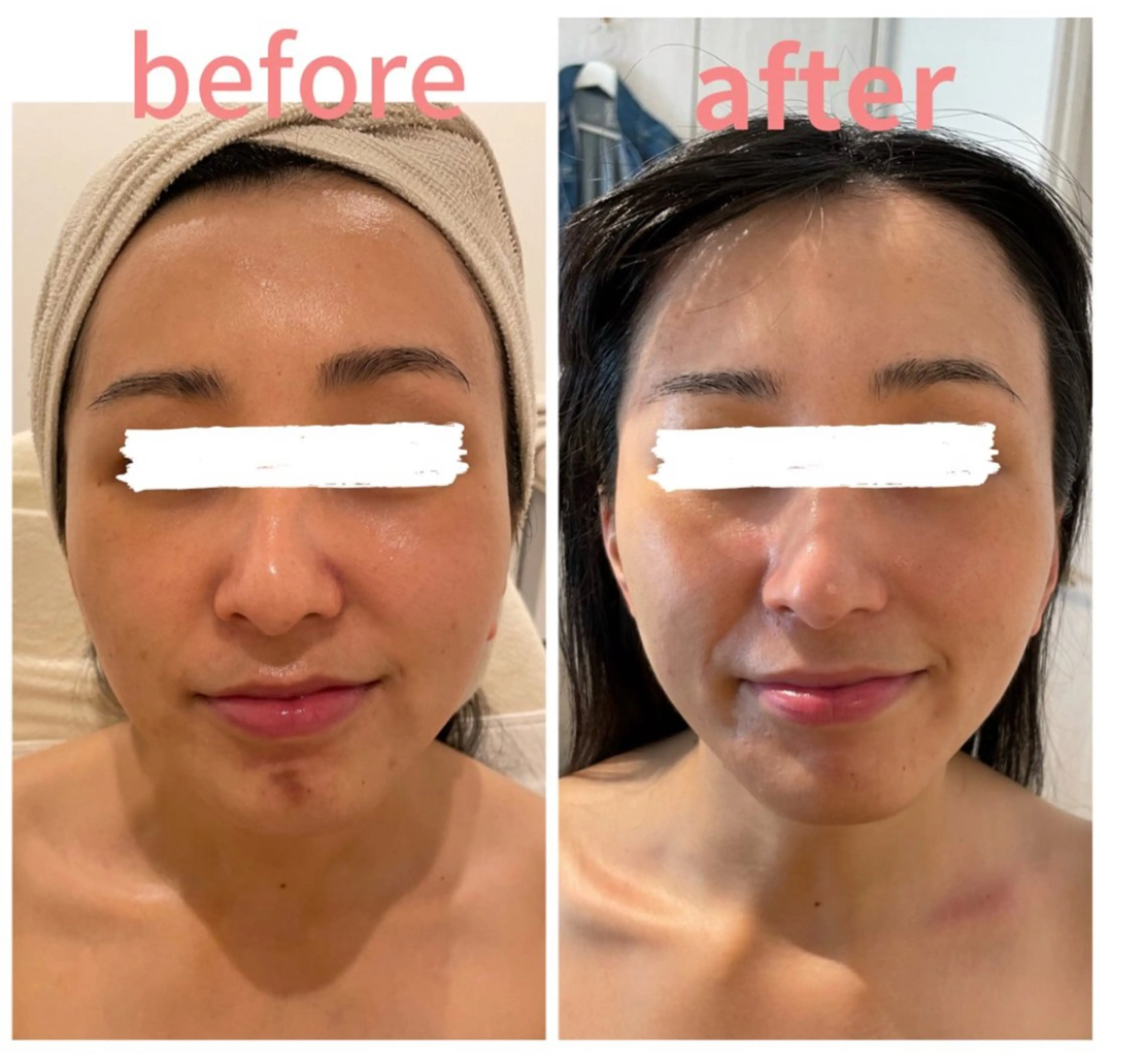 久屋大通フェイシャル エステ　POLAのエステ・リラクイメージ