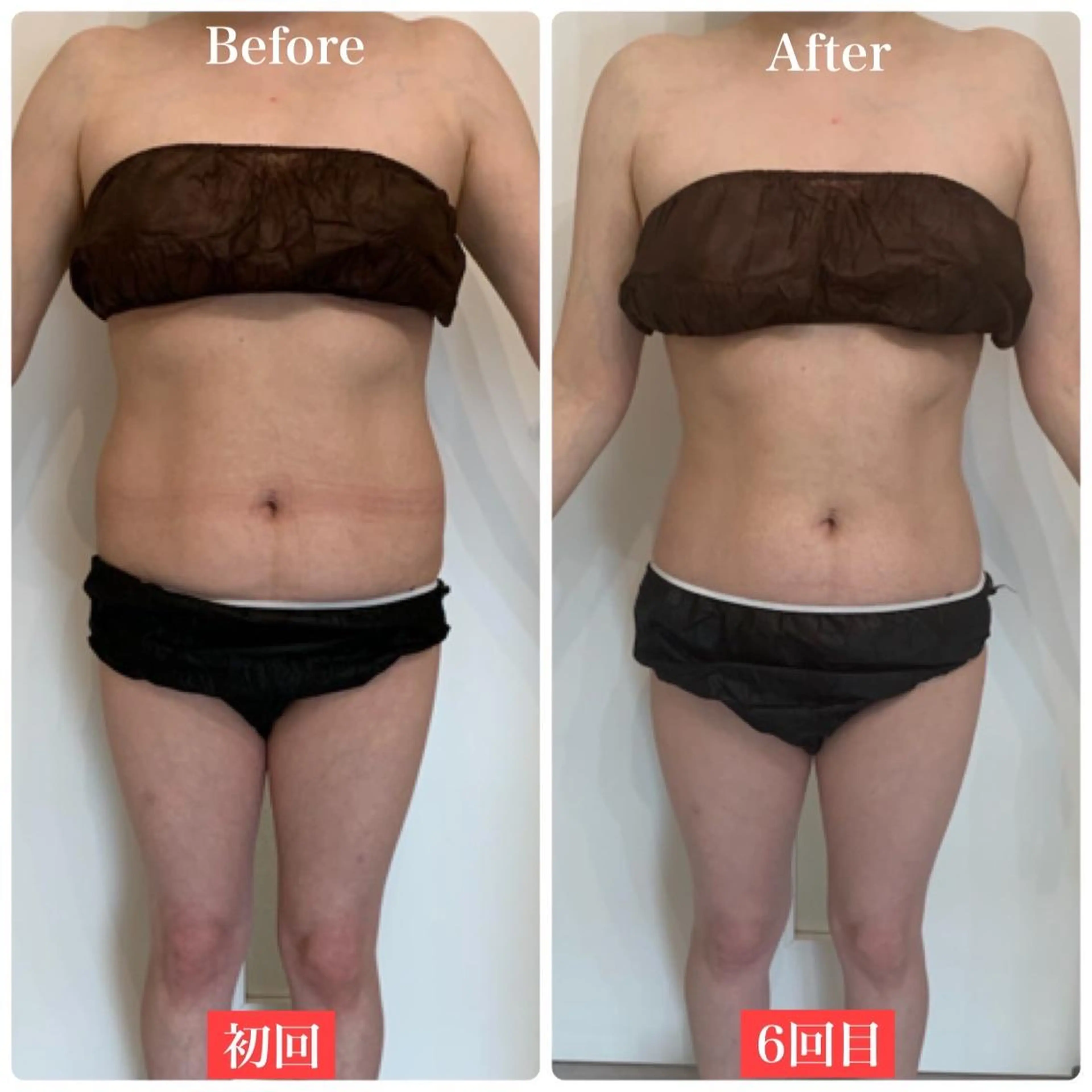 ✨美肌水光✨ アトリエリュバンのエステ・リラクイメージ