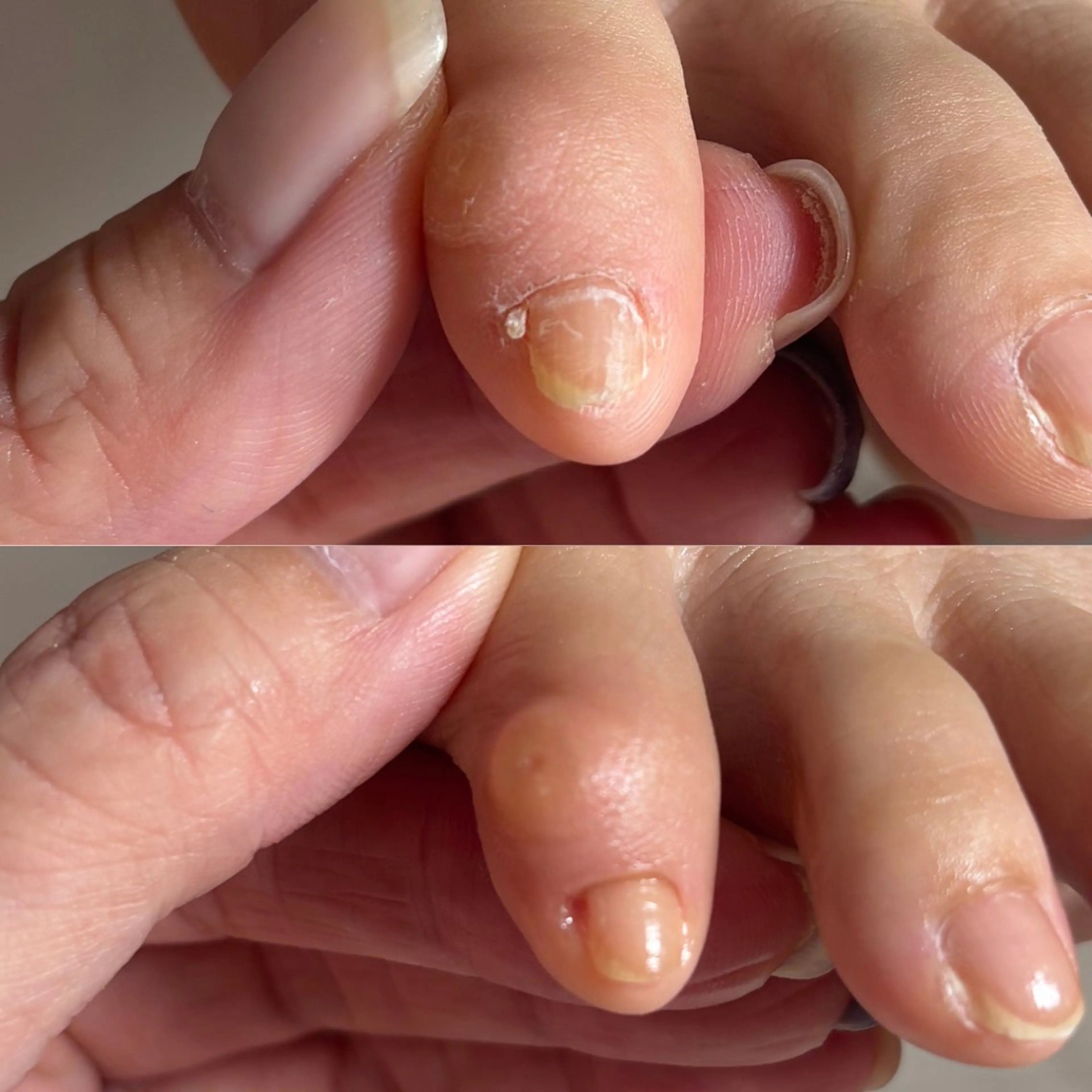 ネイル フットネイル Alo.nail アロ•ネイルのネイルデザイン