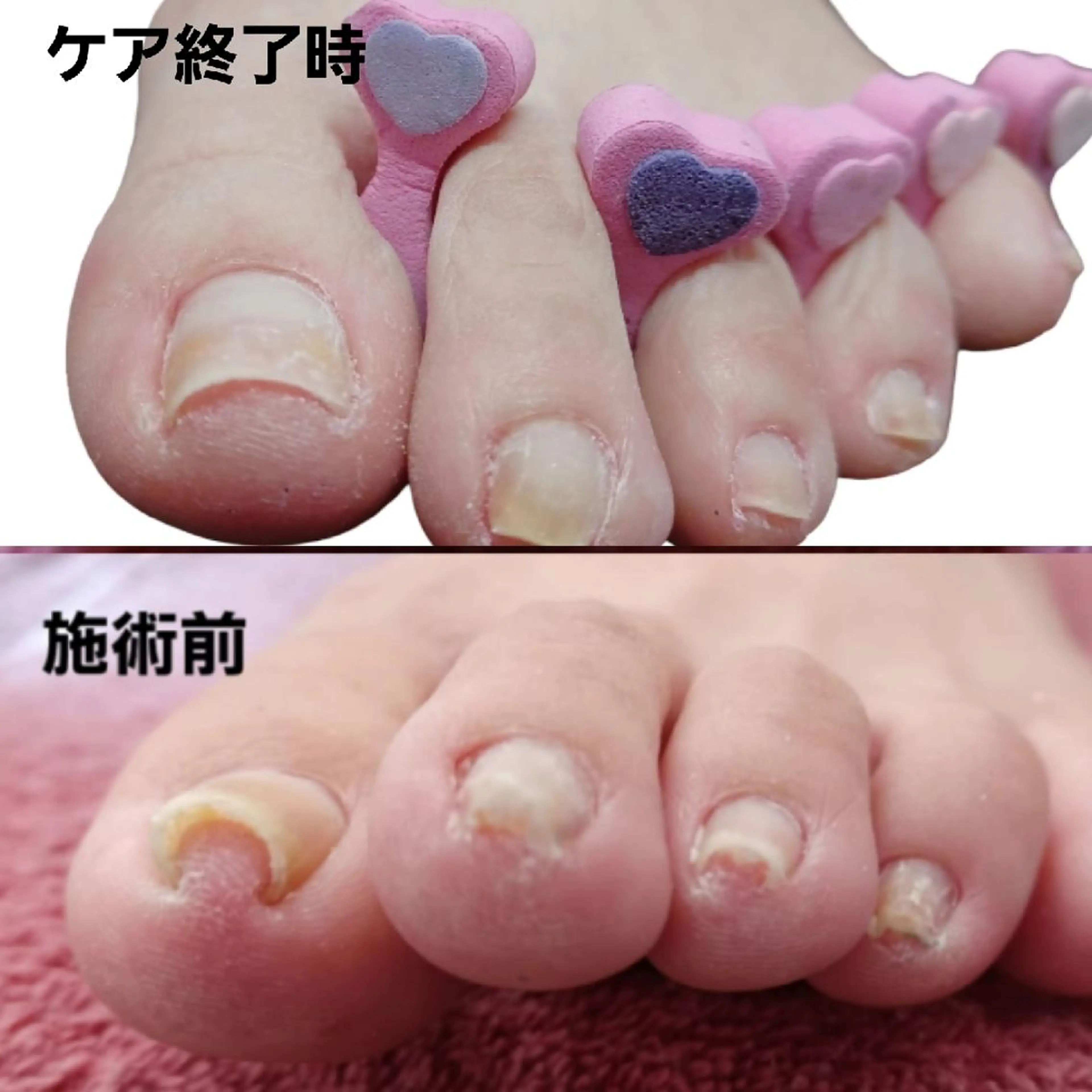 ネイル Micky nail chikushinoのネイルデザイン