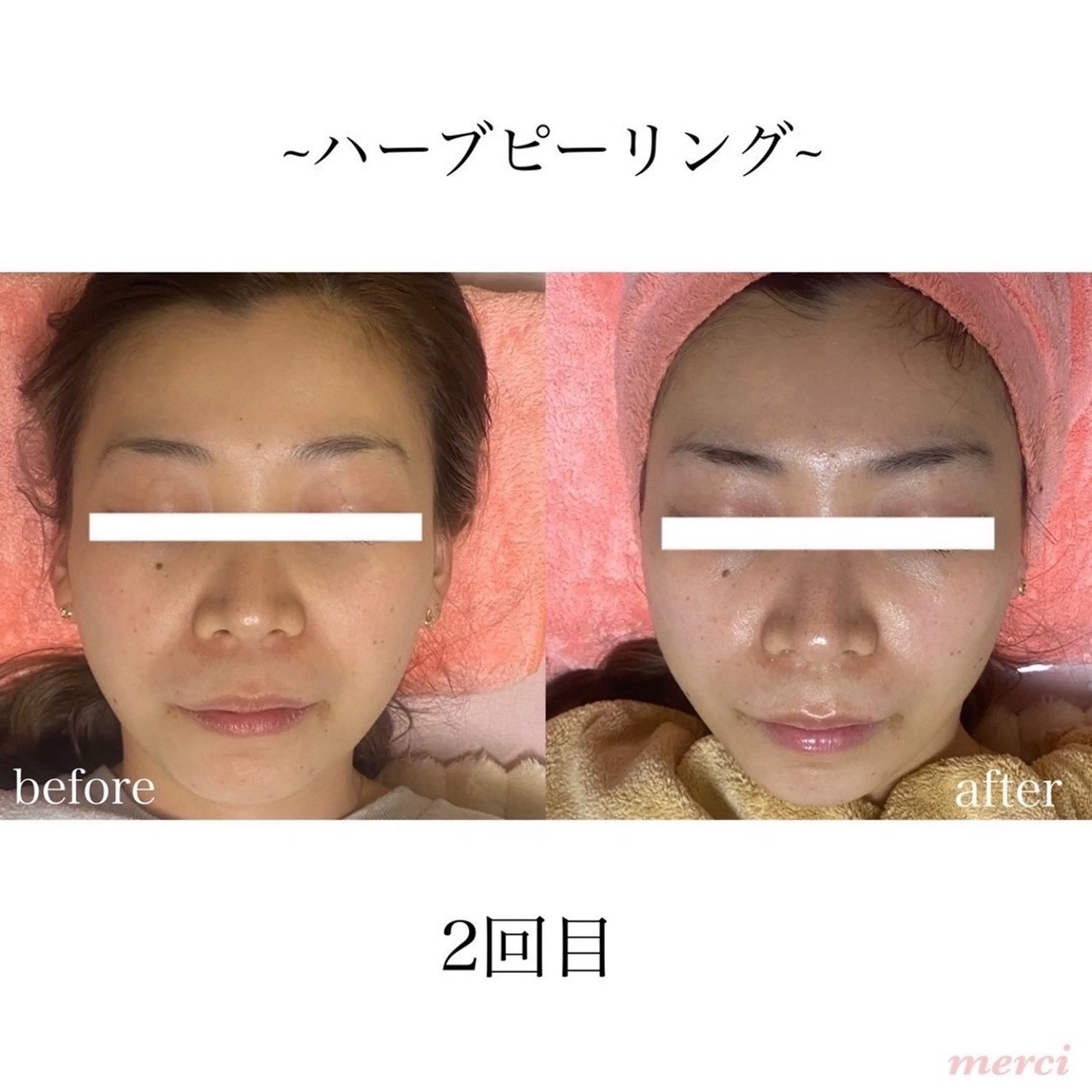 salon merciのエステ・リラクイメージ