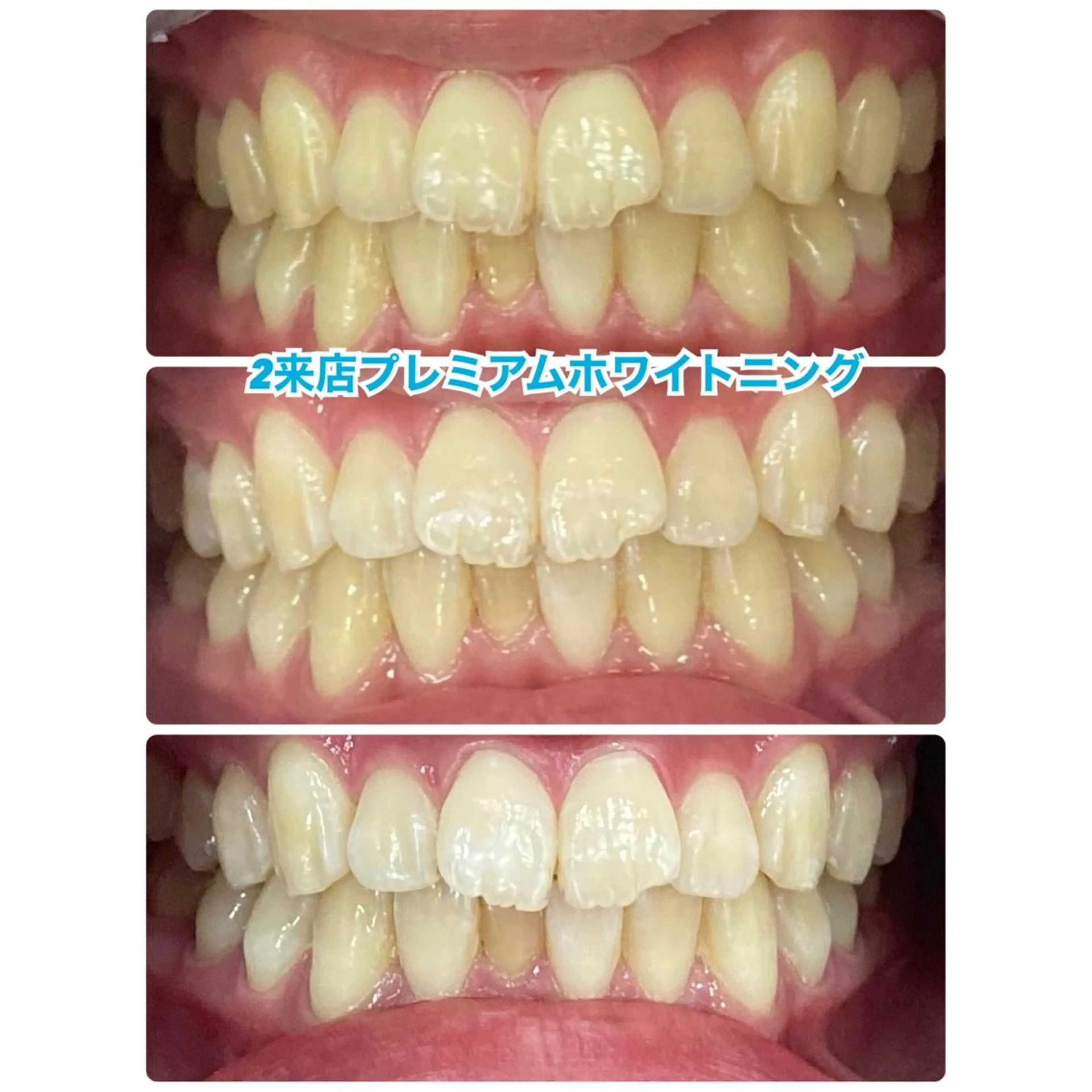 メンズ ネイル マツエク・マツパ アイブロウ ホワイト プラチナムビューティー柏所属・【歯科提携】柏ホワイ トニング専門店のその他イメージ