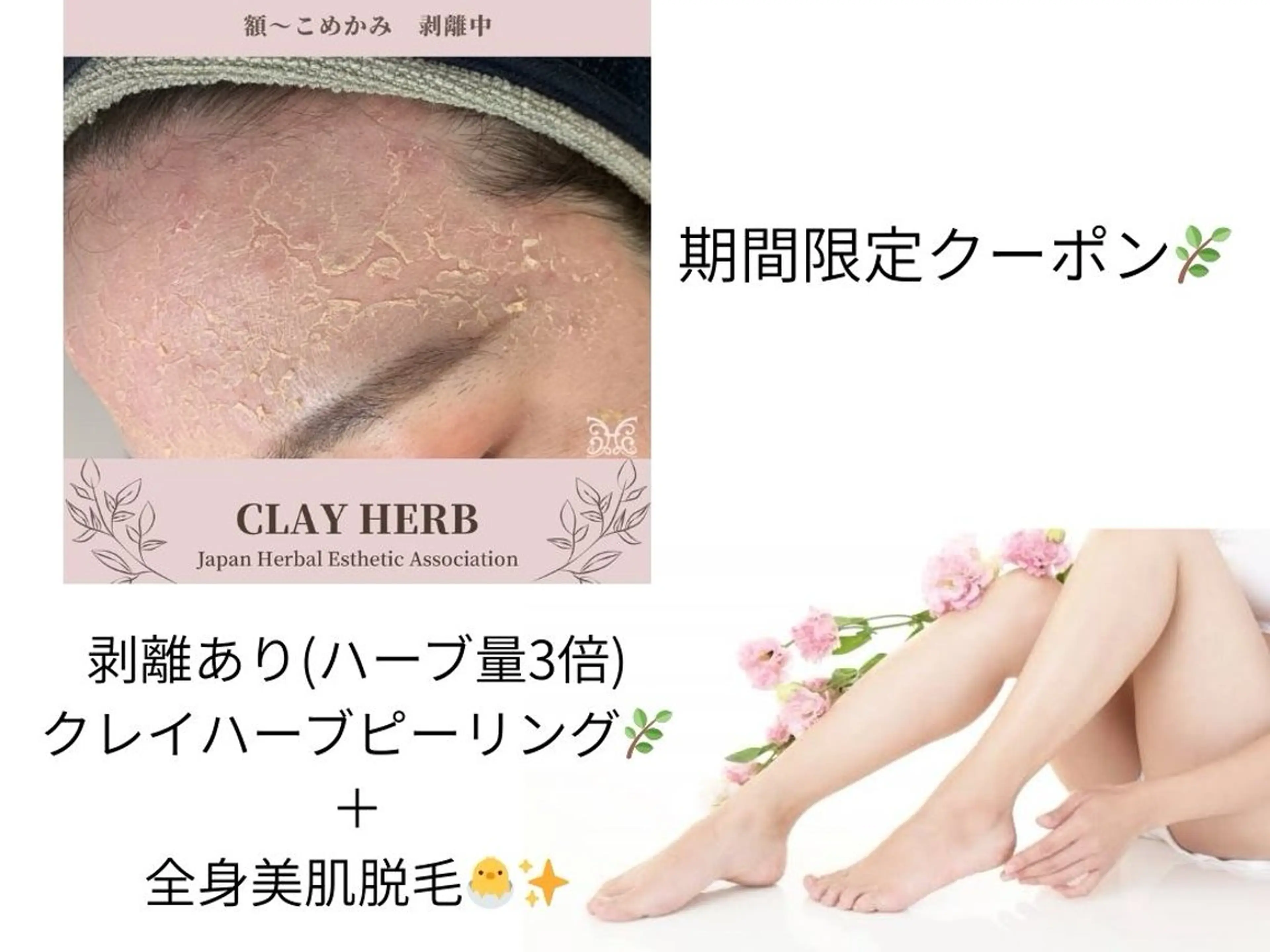 【9月限定】全身脱毛＋剥離ありクレイハーブピーリング　40,000円→30,000円の写真