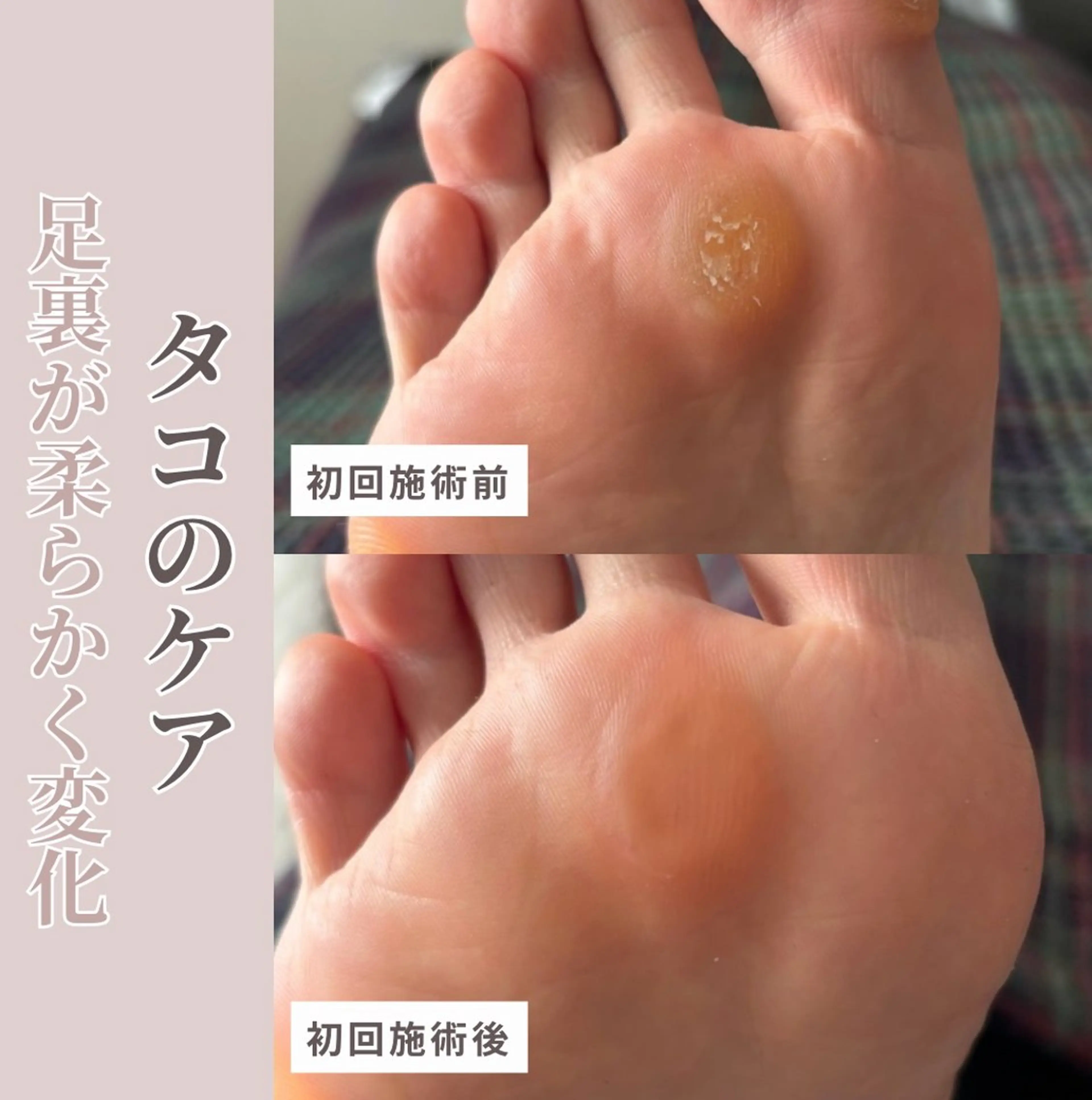 ネイル フットネイル Studio Jivanのネイルデザイン