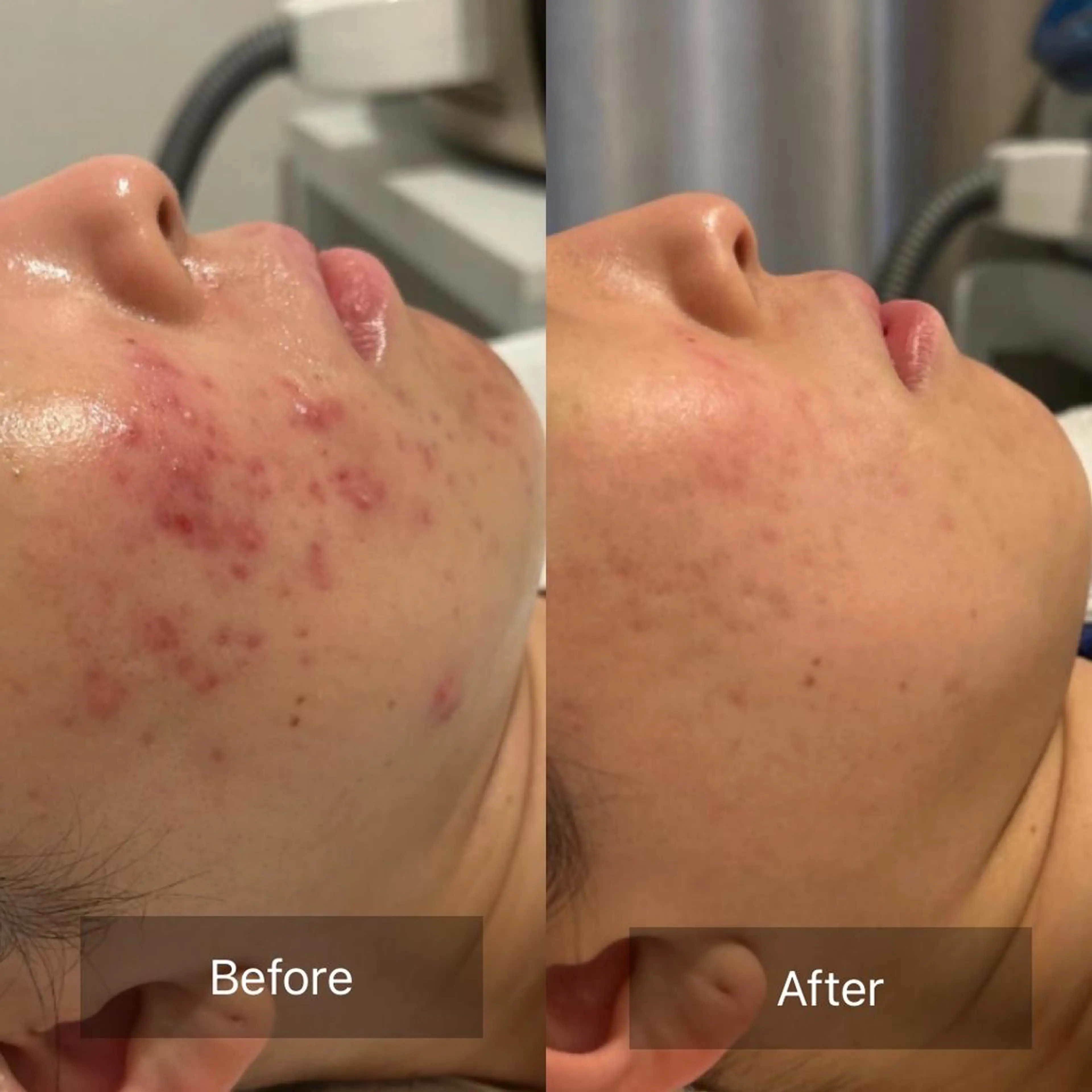 【美肌・脱毛専門店】 SARA 恵比寿店のエステ・リラクイメージ