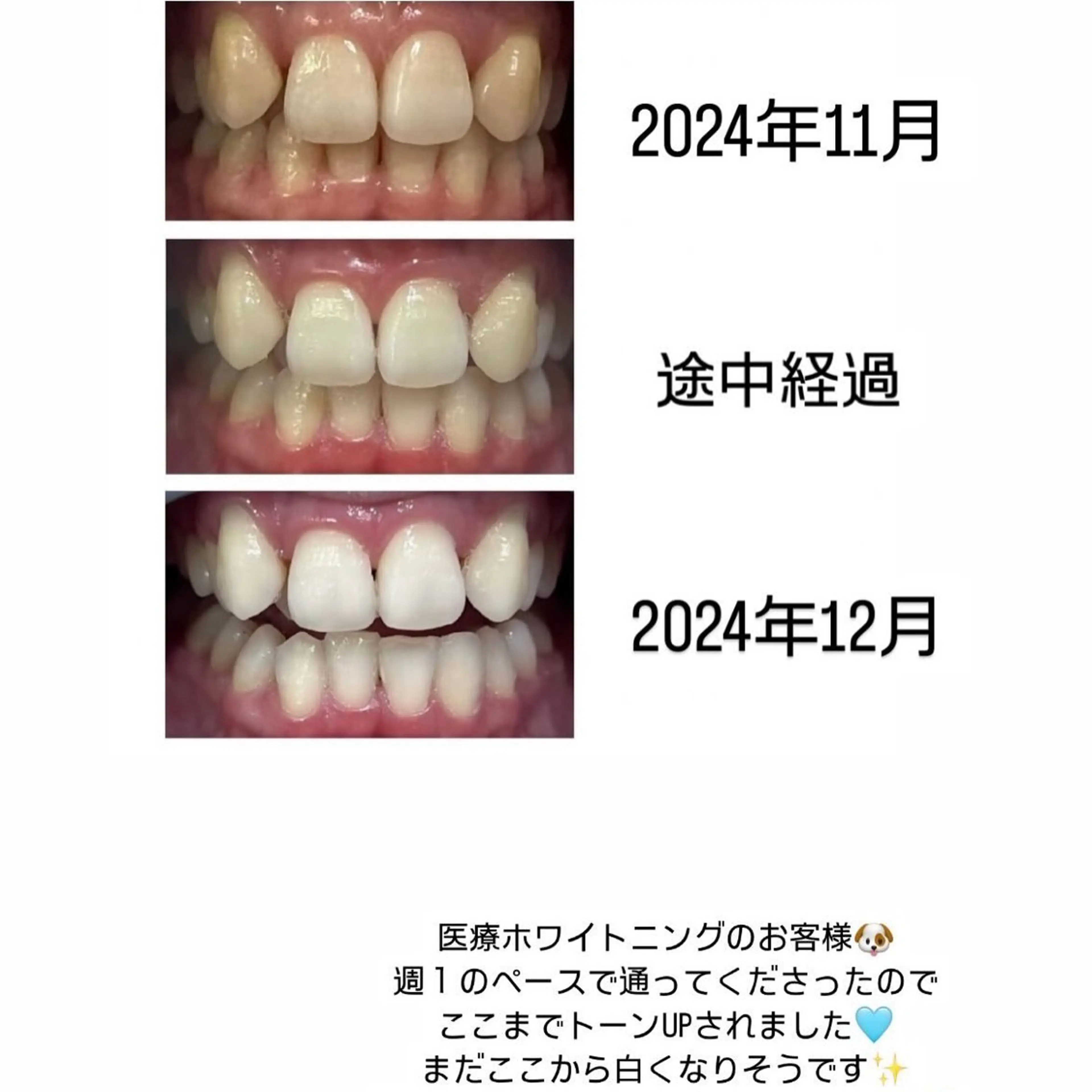 Kaula所属・Kaula セルフホワイトニングのその他イメージ