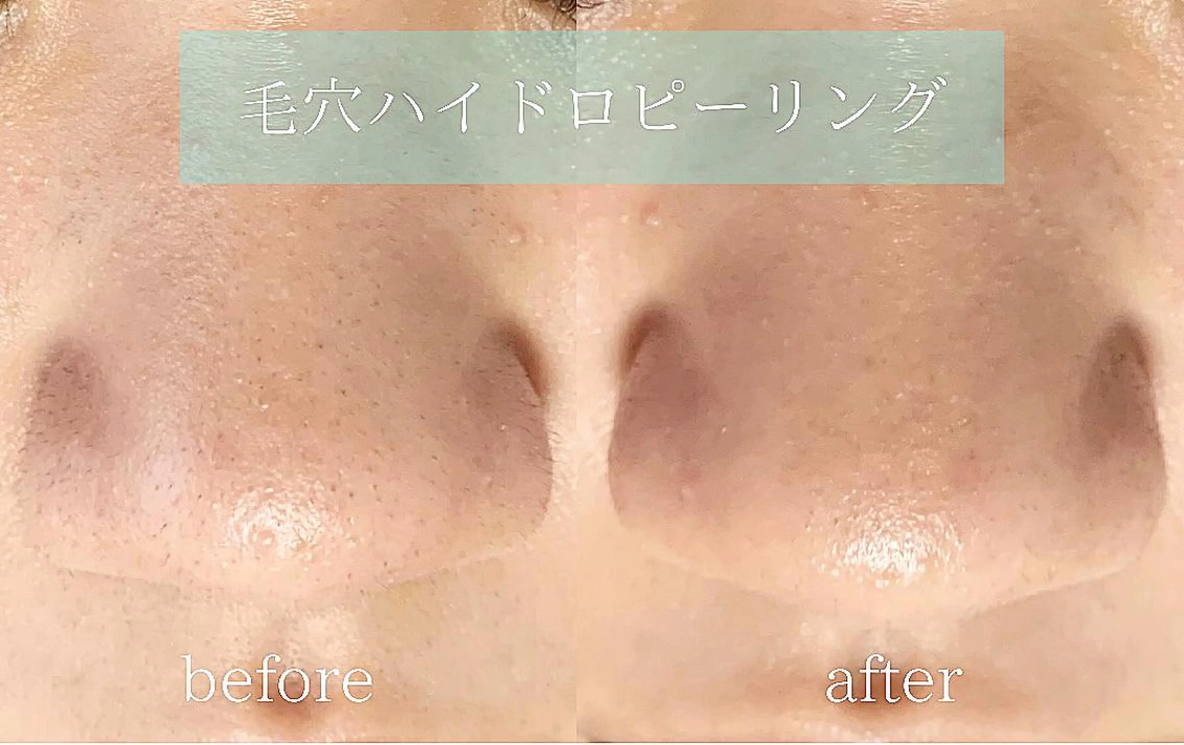 メンズ エステ salonLADYSTYLE所属・稲嶺 美華のエステ・リラクイメージ