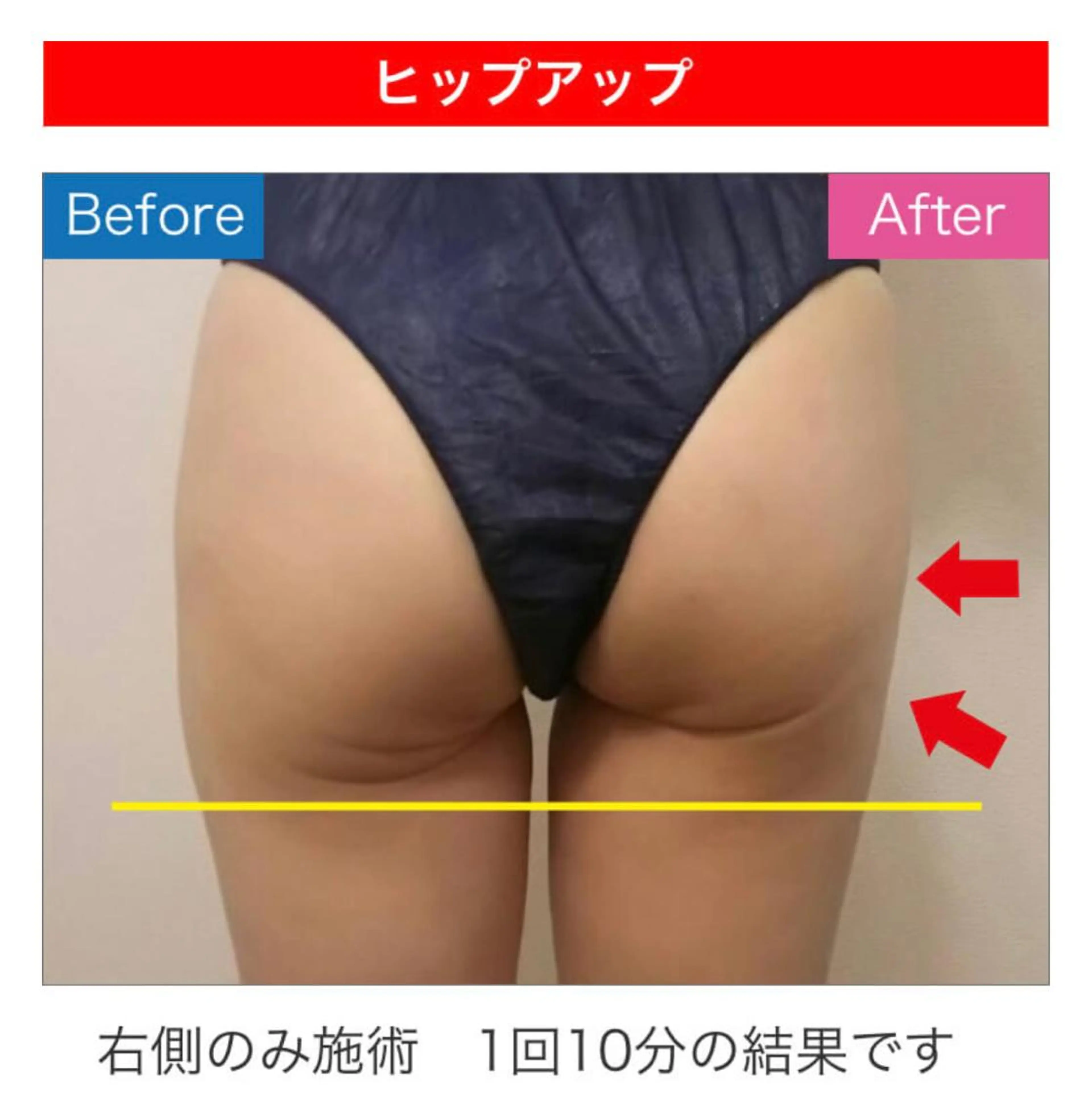 エステサロン Mi-mi.iのエステ・リラクイメージ