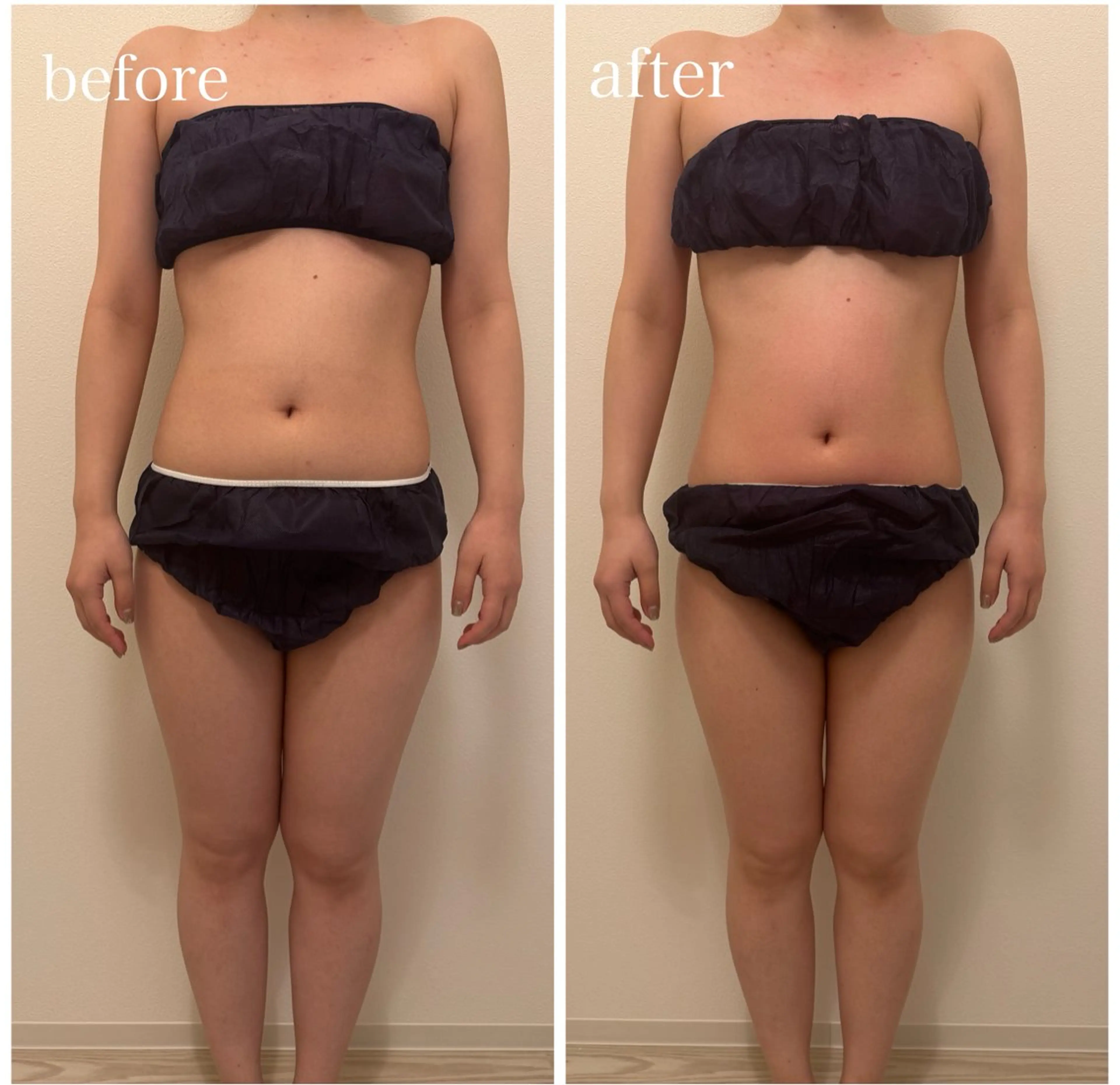 エステ 23beauty所属・武藤 那月のエステ・リラクイメージ