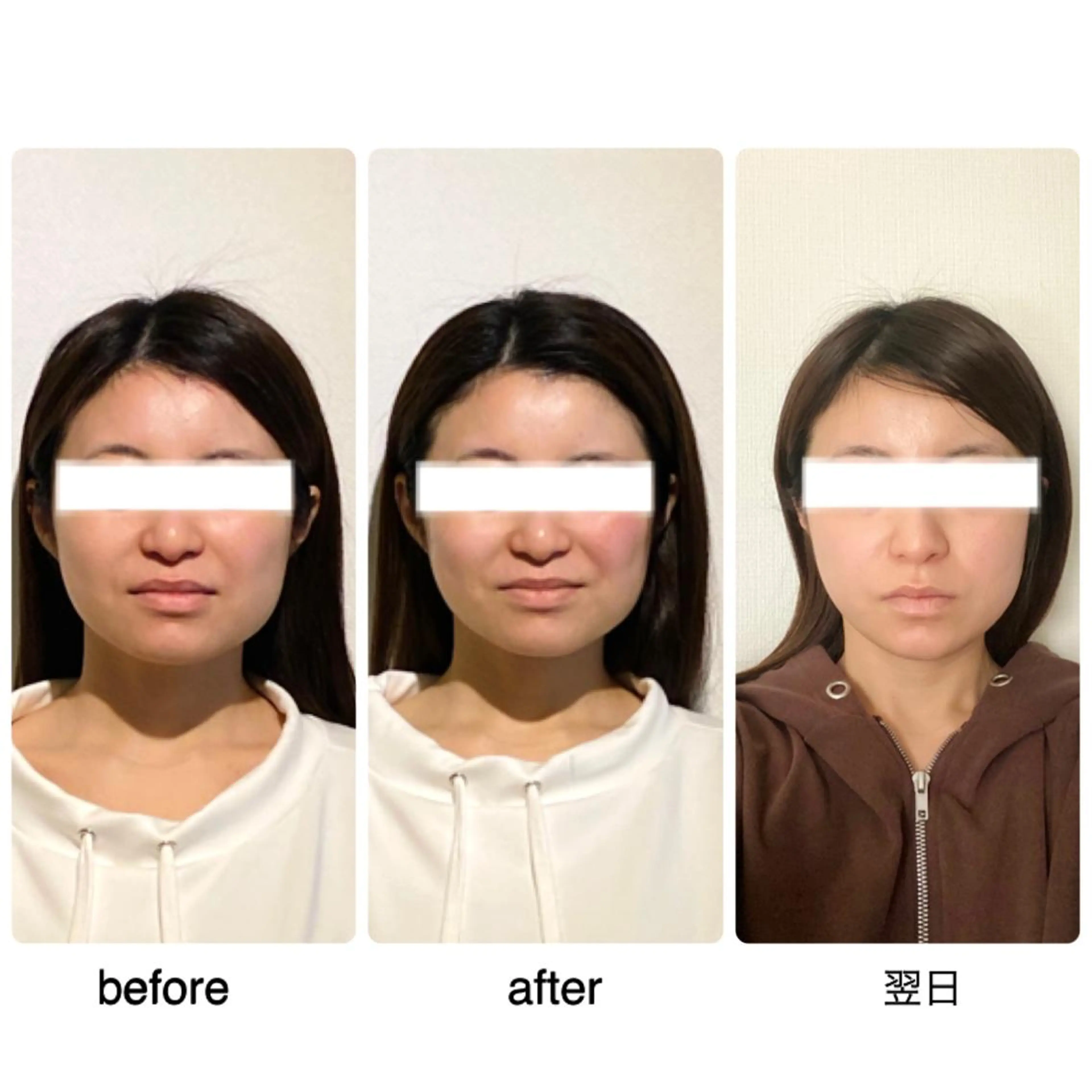 セミロング ヘアアレンジ ネイル 小顔矯正専門サロンジュマリ所属・町田 淳子のエステ・リラクイメージ