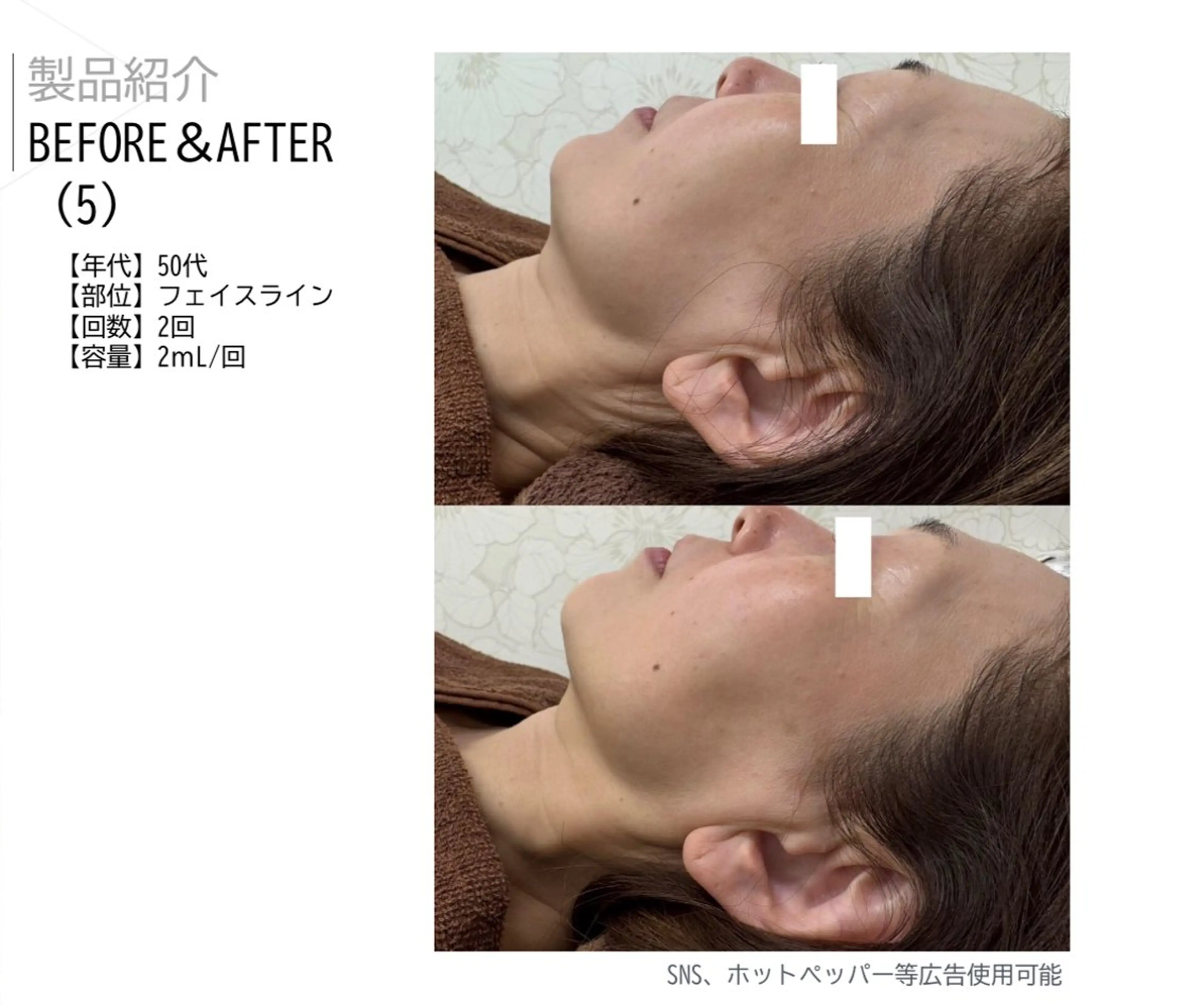 ベルーテ エッセンスのエステ・リラクイメージ