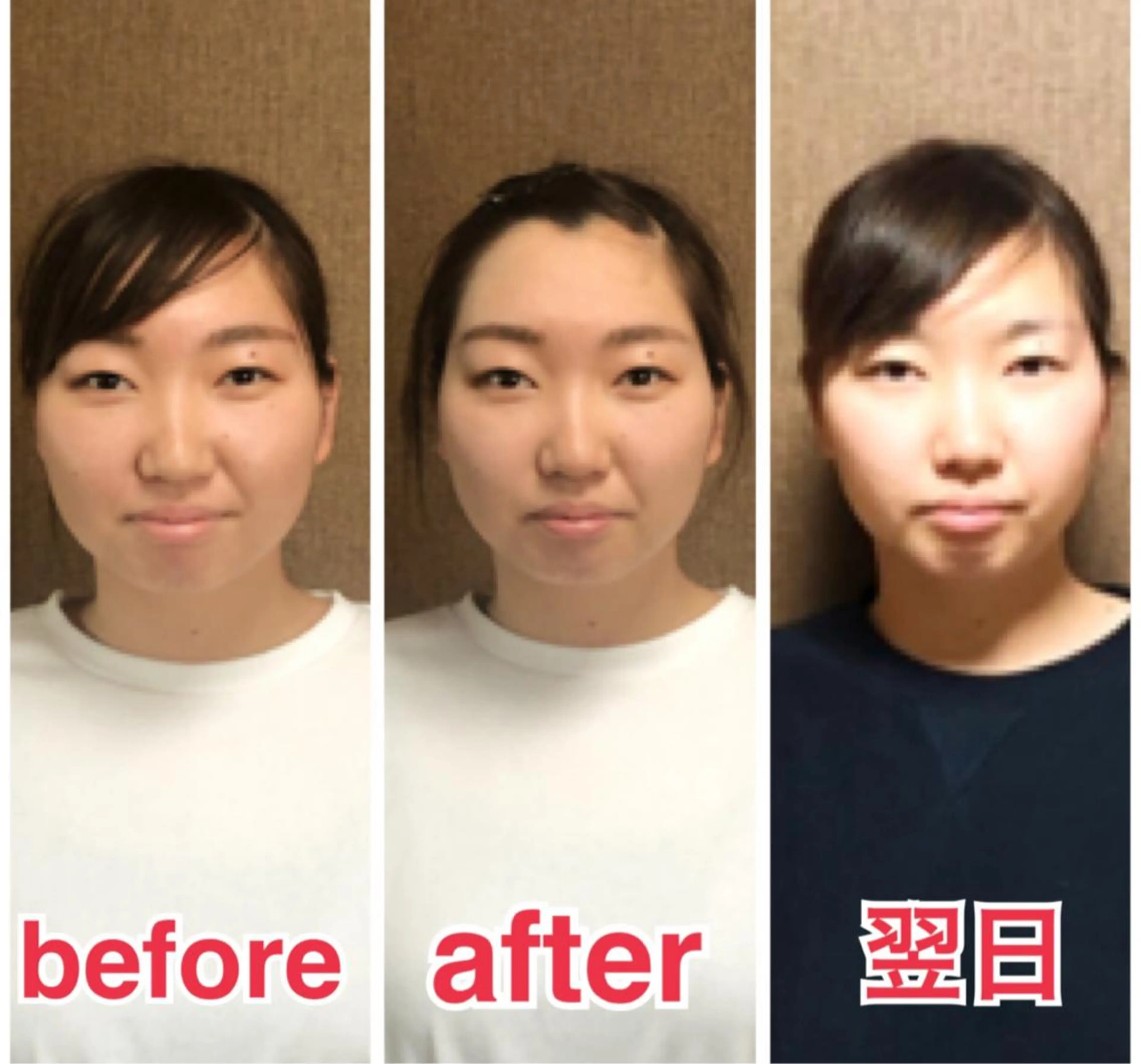 小顔矯正専門サロンジュマリ所属・町田 淳子のエステ・リラクイメージ