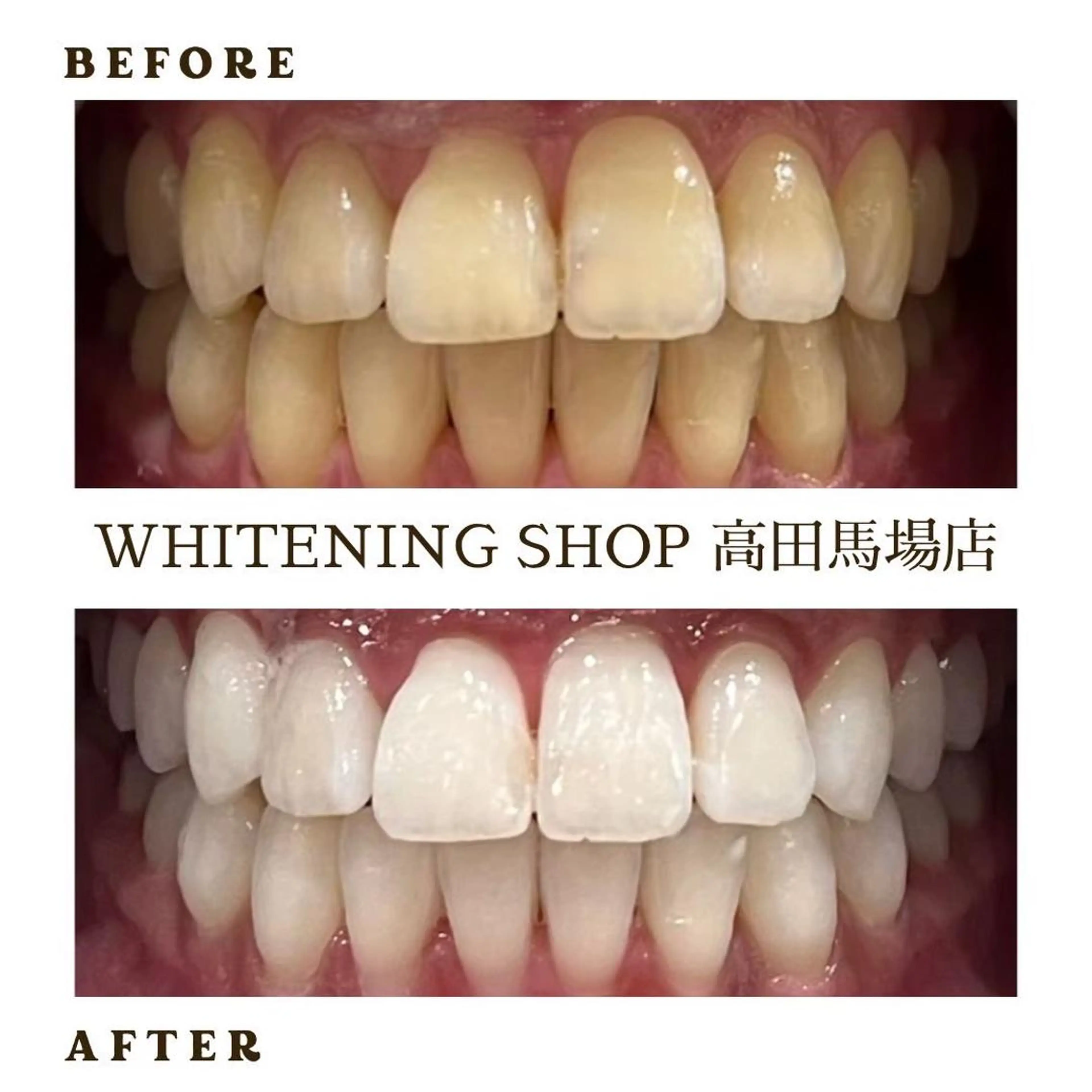 メンズ その他 ホワイトニング ショップ高田馬場店のその他イメージ