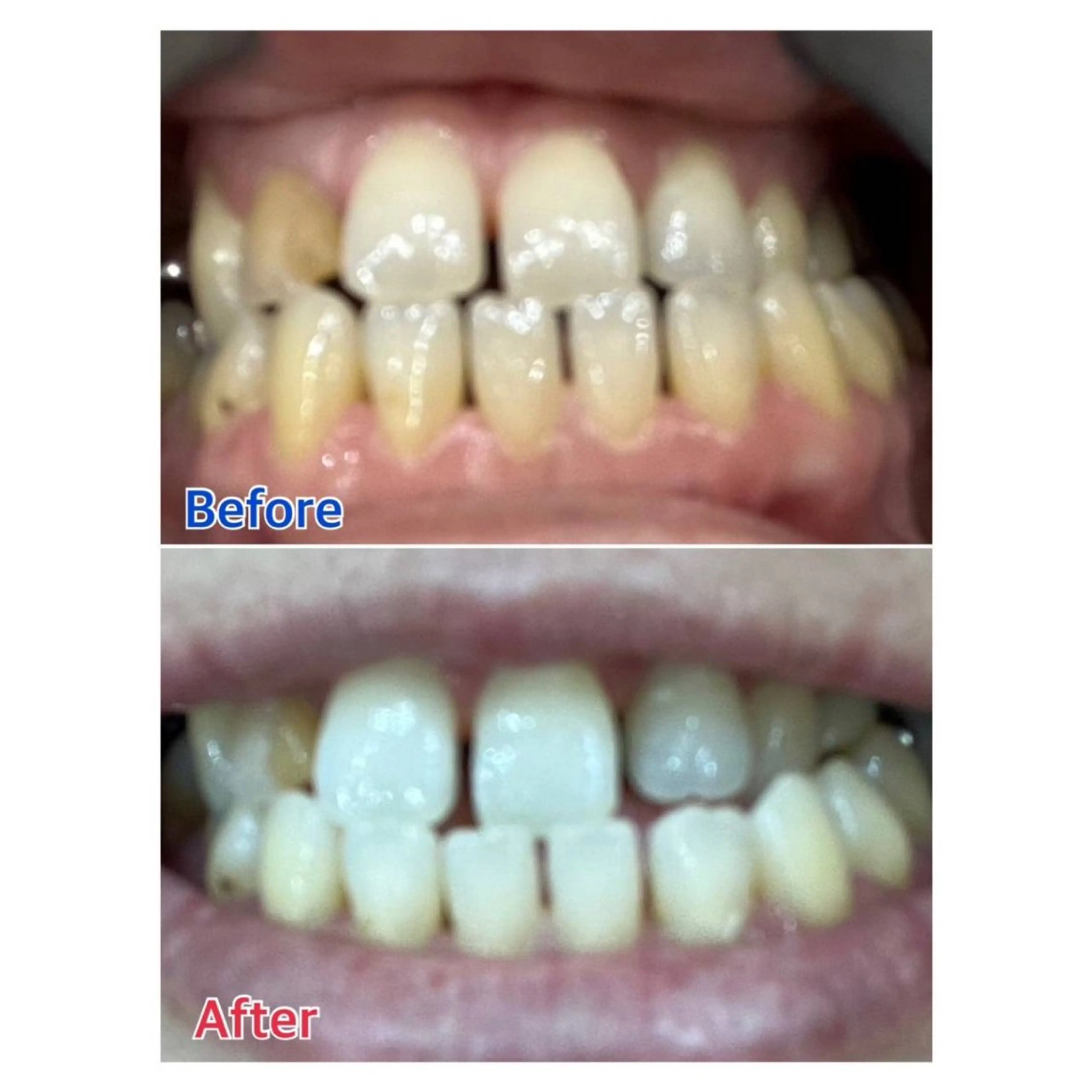 MBEAUTYSALON 千葉店・京成大久保所属・Melty 輝のその他イメージ