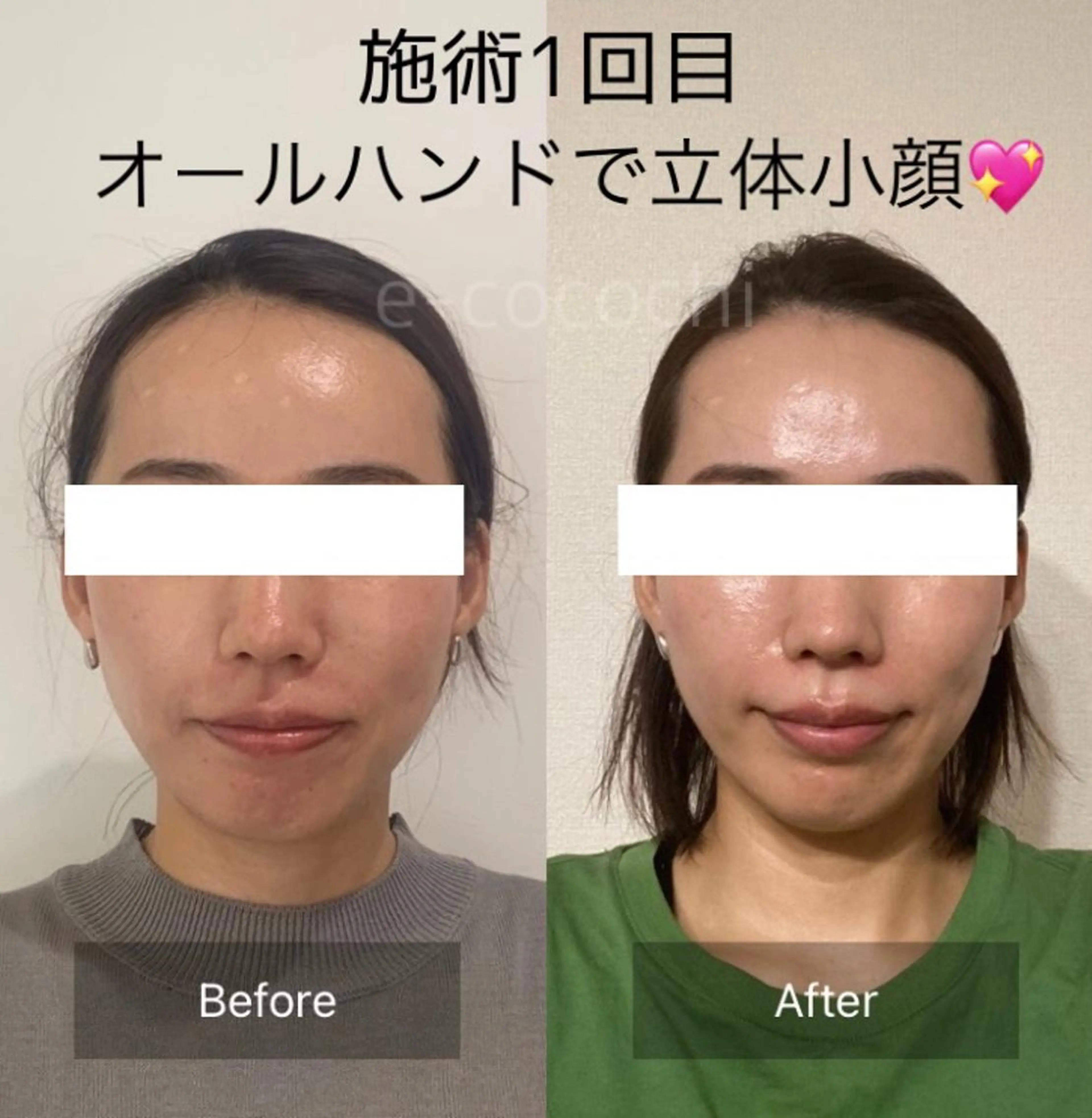 エステ リラク 小顔と ヘッドスパのお店のエステ・リラクイメージ