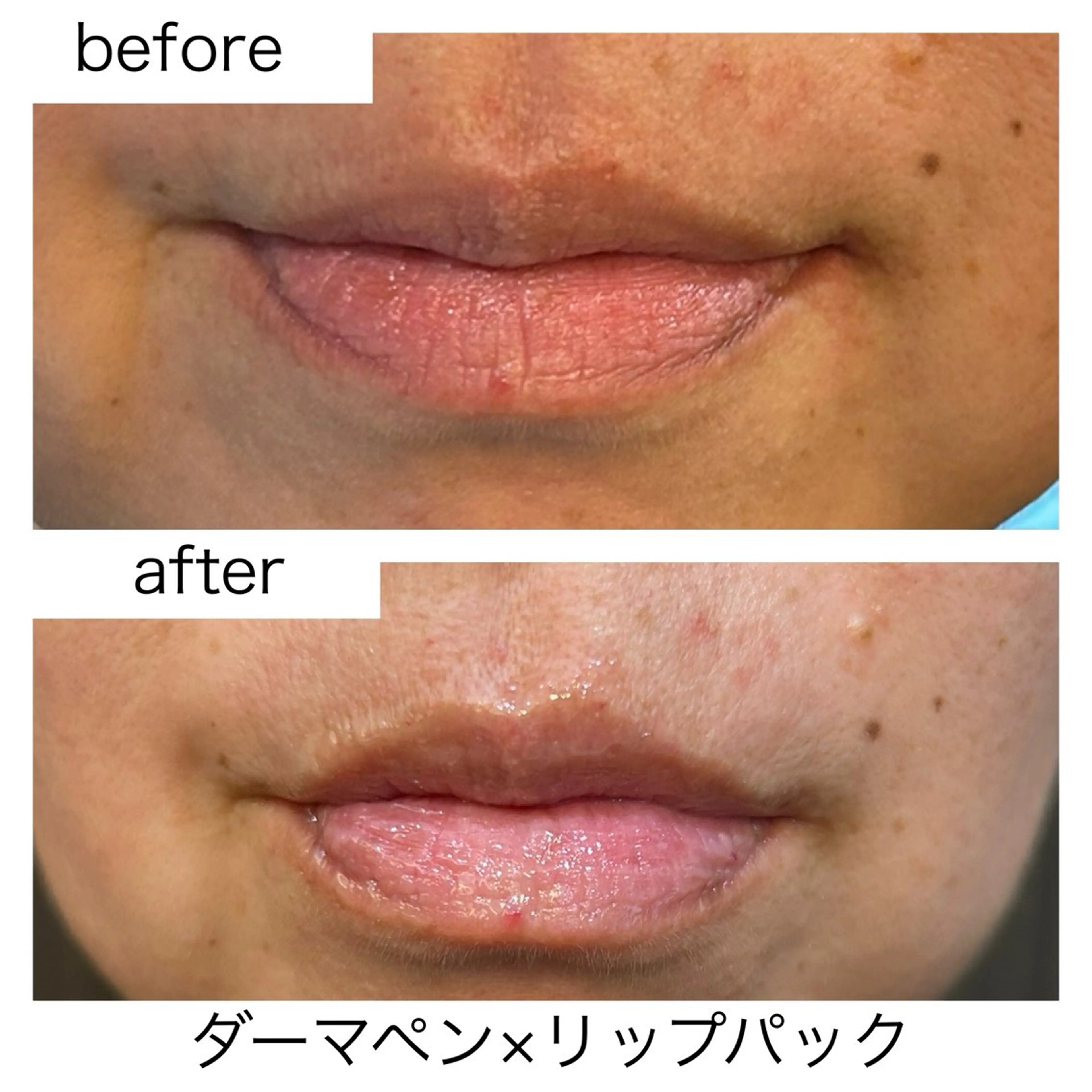 leolo武蔵浦和 肌質改善&脱毛のエステ・リラクイメージ