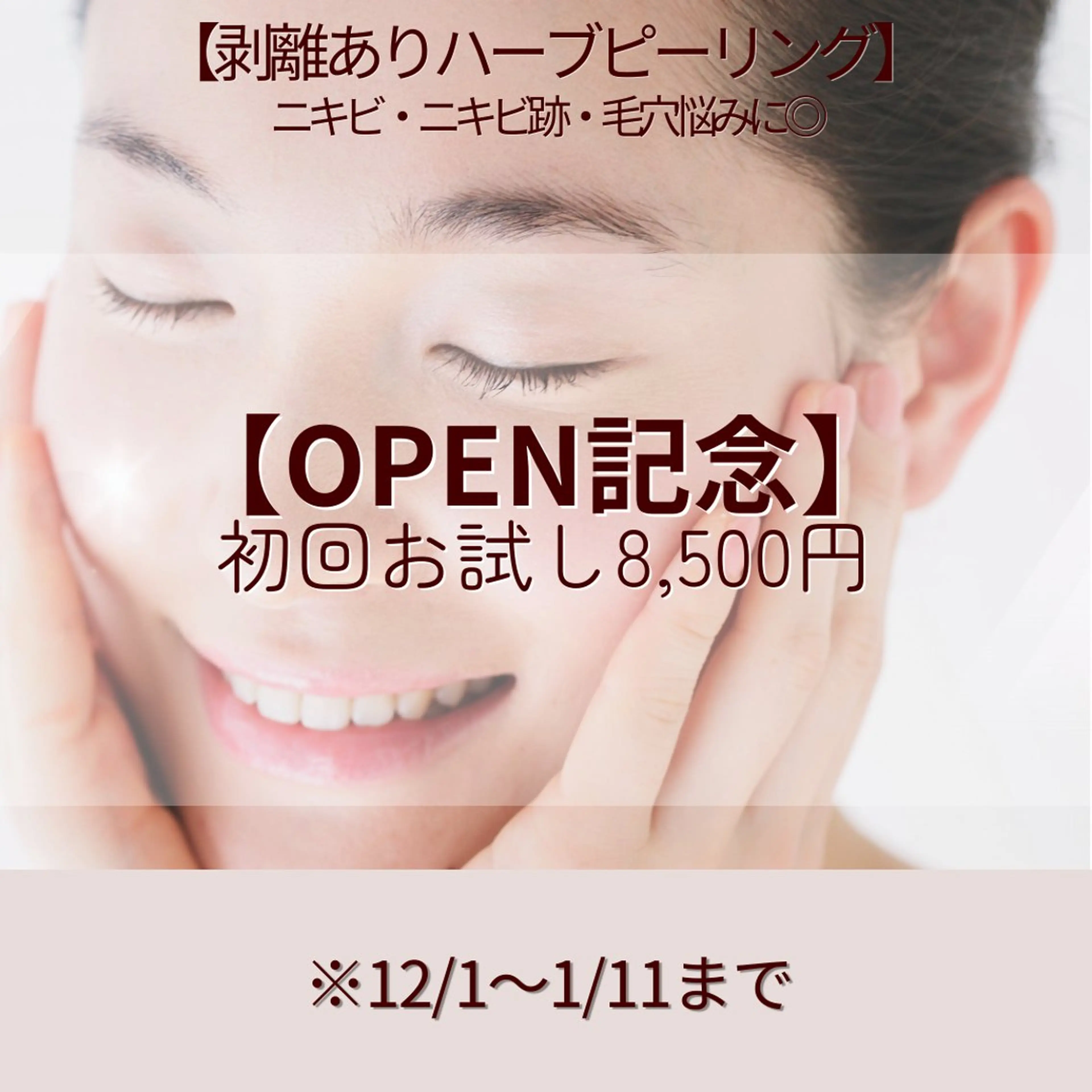 OPEN記念【全顔】剥離ありハーブピーリング🌿ニキビ・ニキビ跡・クレーター・毛穴ケア・くすみの写真