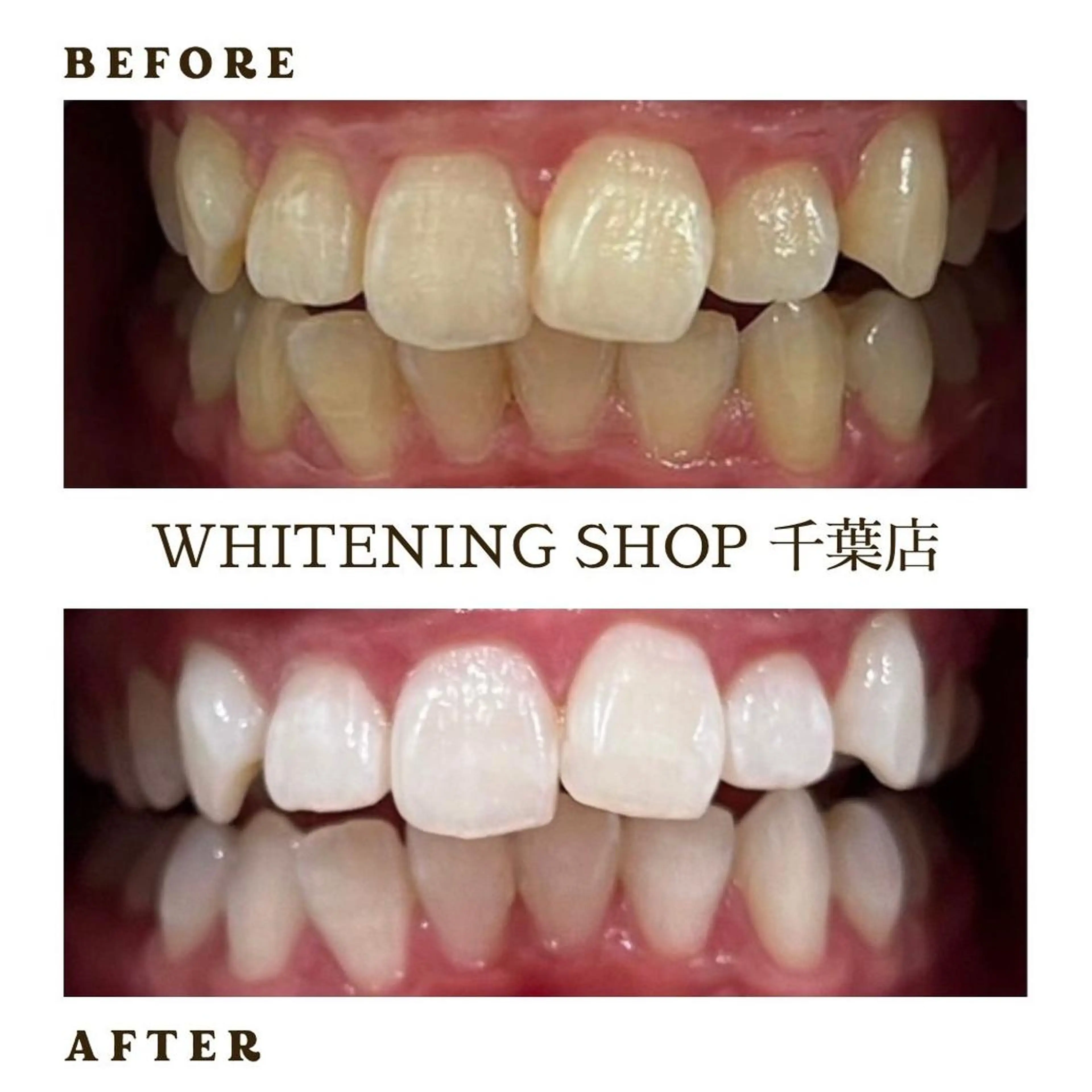 メンズ その他 ホワイトニング ショップ千葉店のその他イメージ