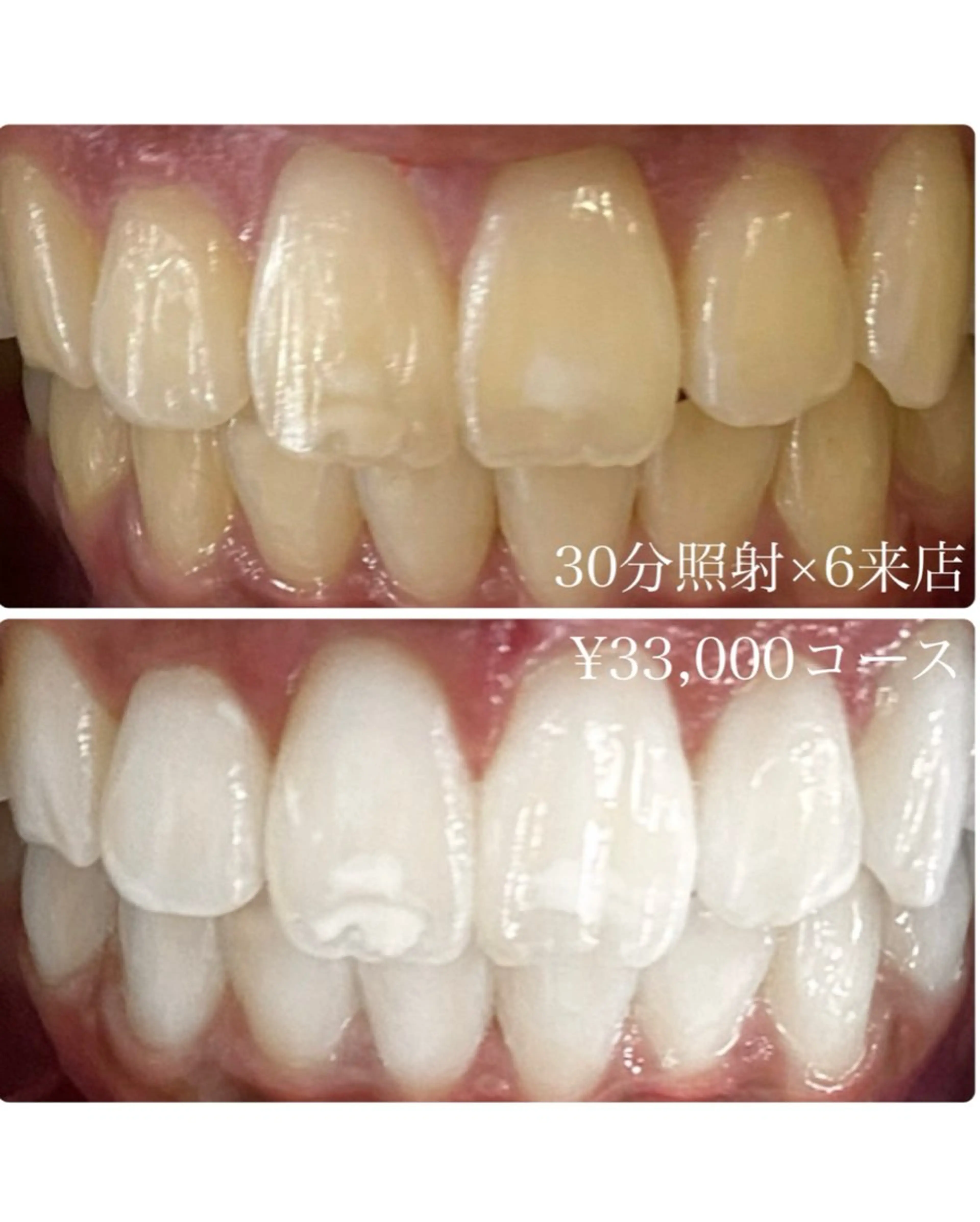 メンズ その他 ホワイトニングルーム　川崎店所属・ホワイトニング ルーム　川崎店のその他イメージ