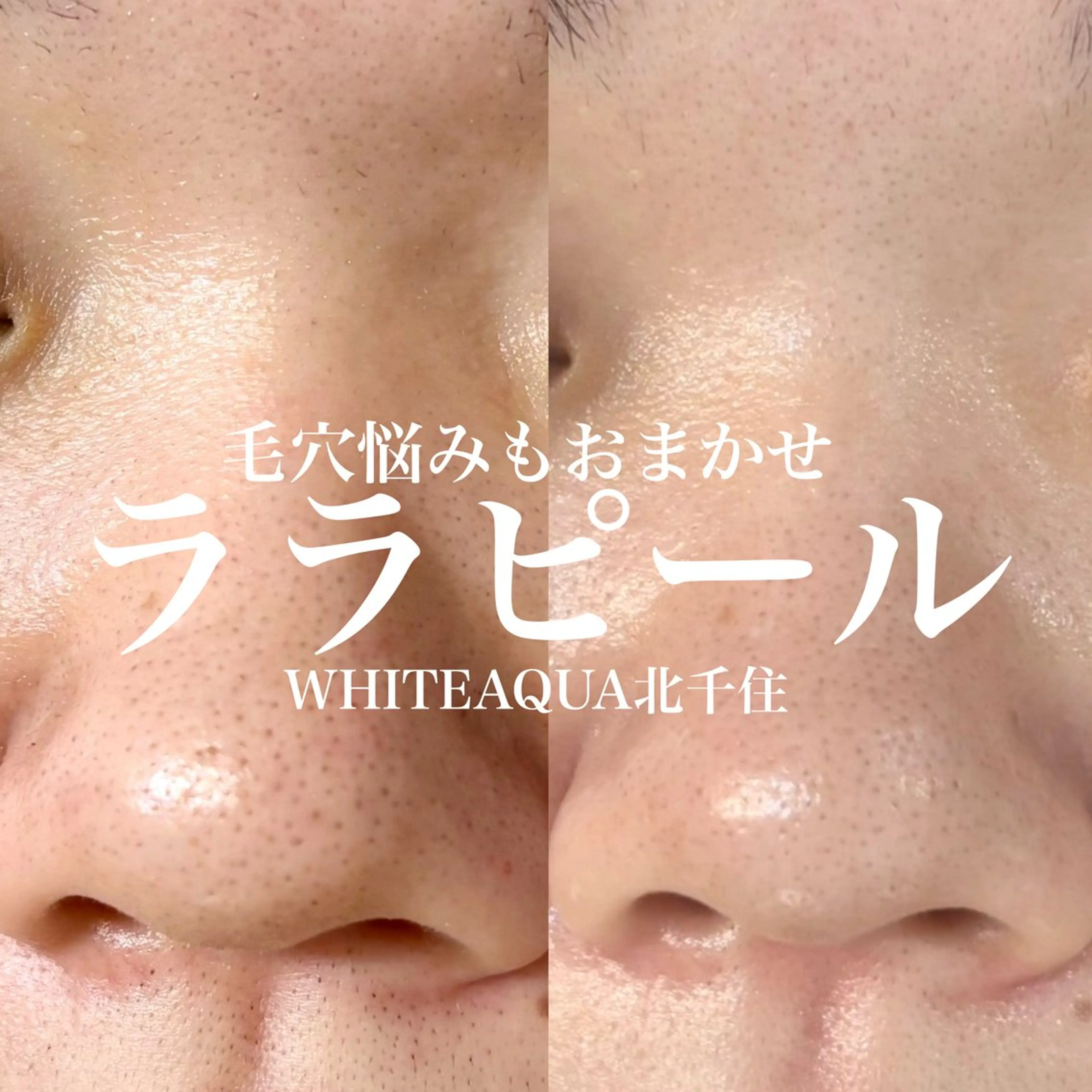 エステ WHITE AQUA 北千住店のエステ・リラクイメージ