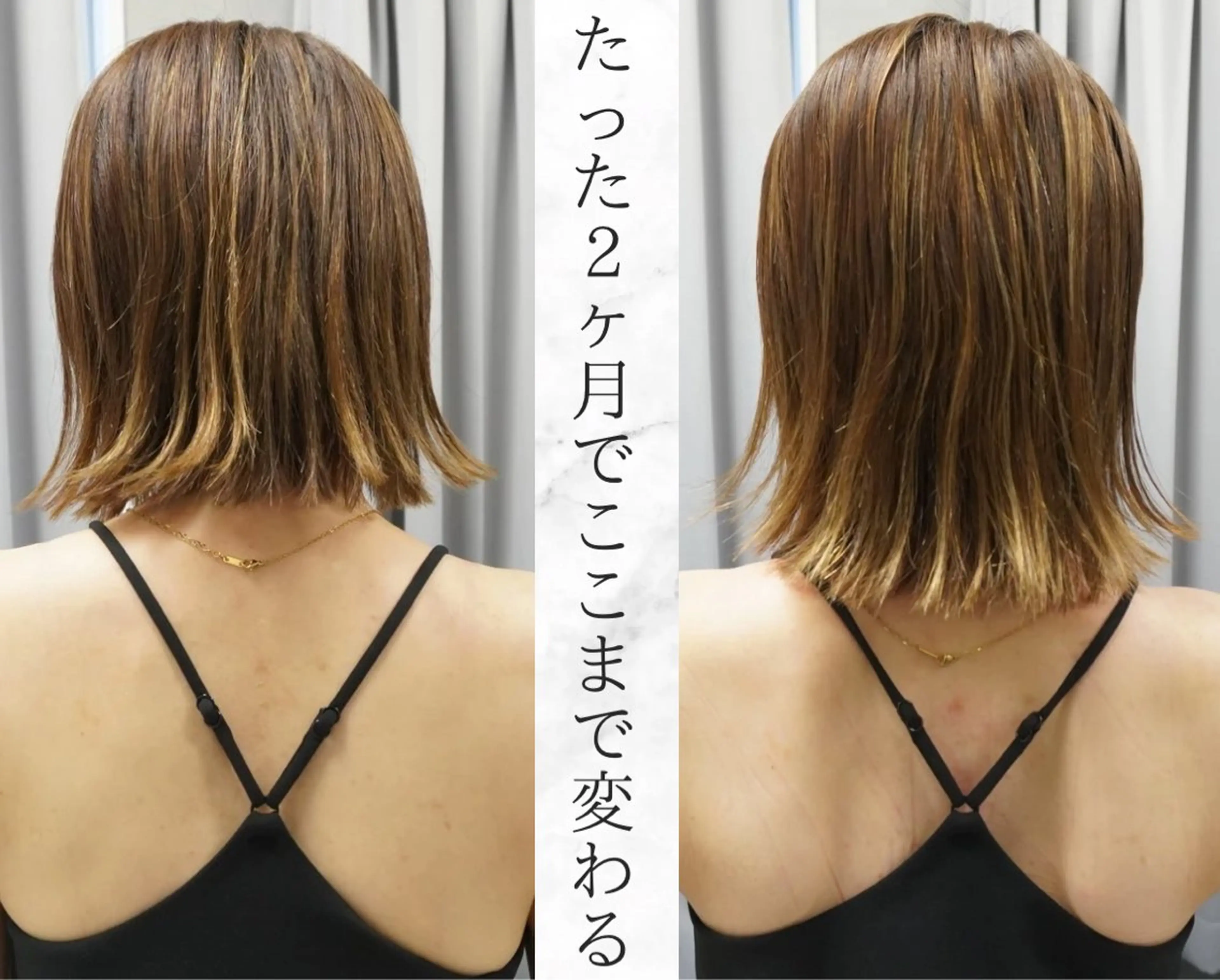 立った2ヶ月で「ドレスが似合う背中に」◯60分8800円→初回4500円の写真